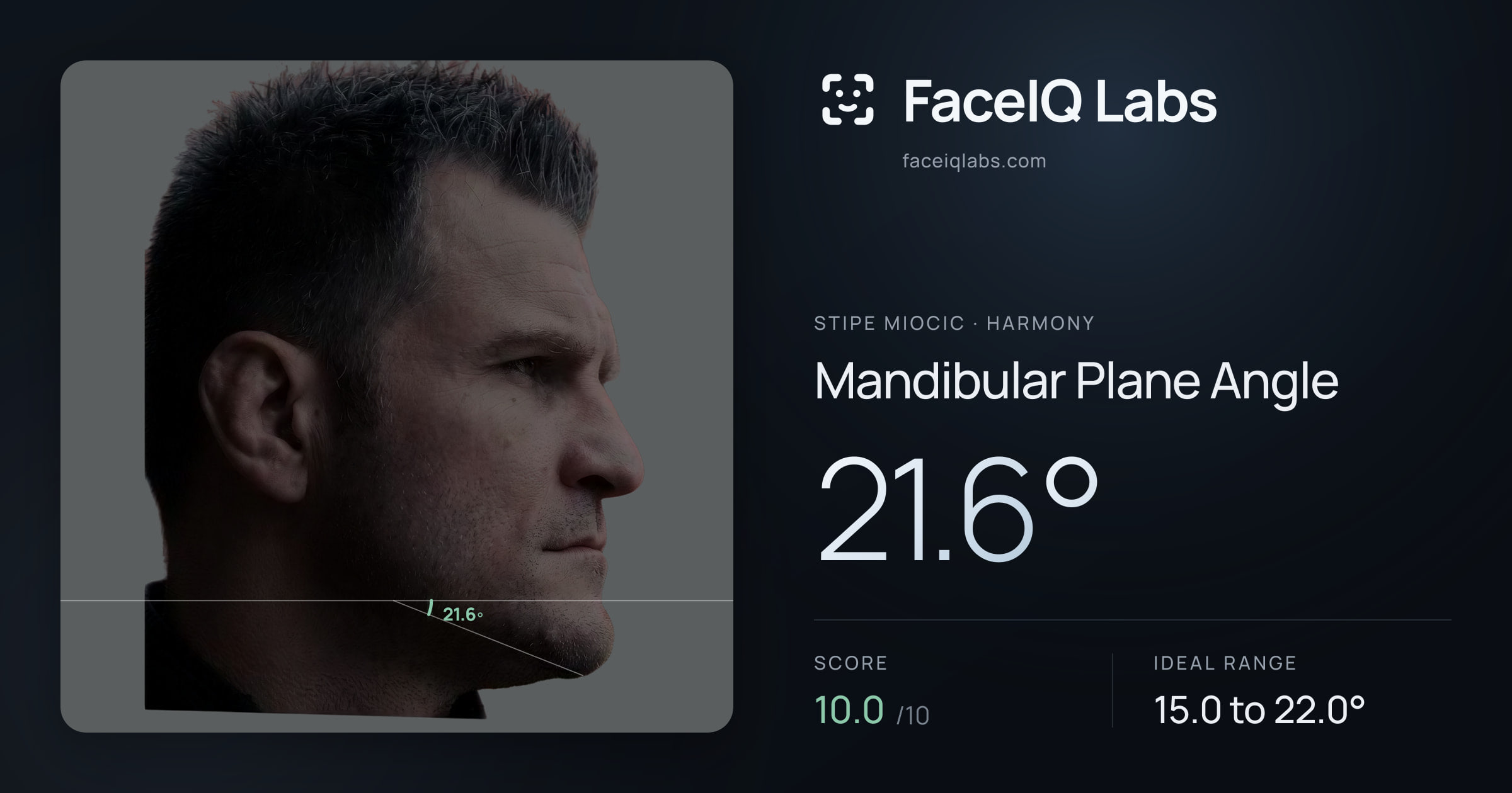 Stipe Miocic Mandibular Plane Angle: 21.6°, drawn on the photo