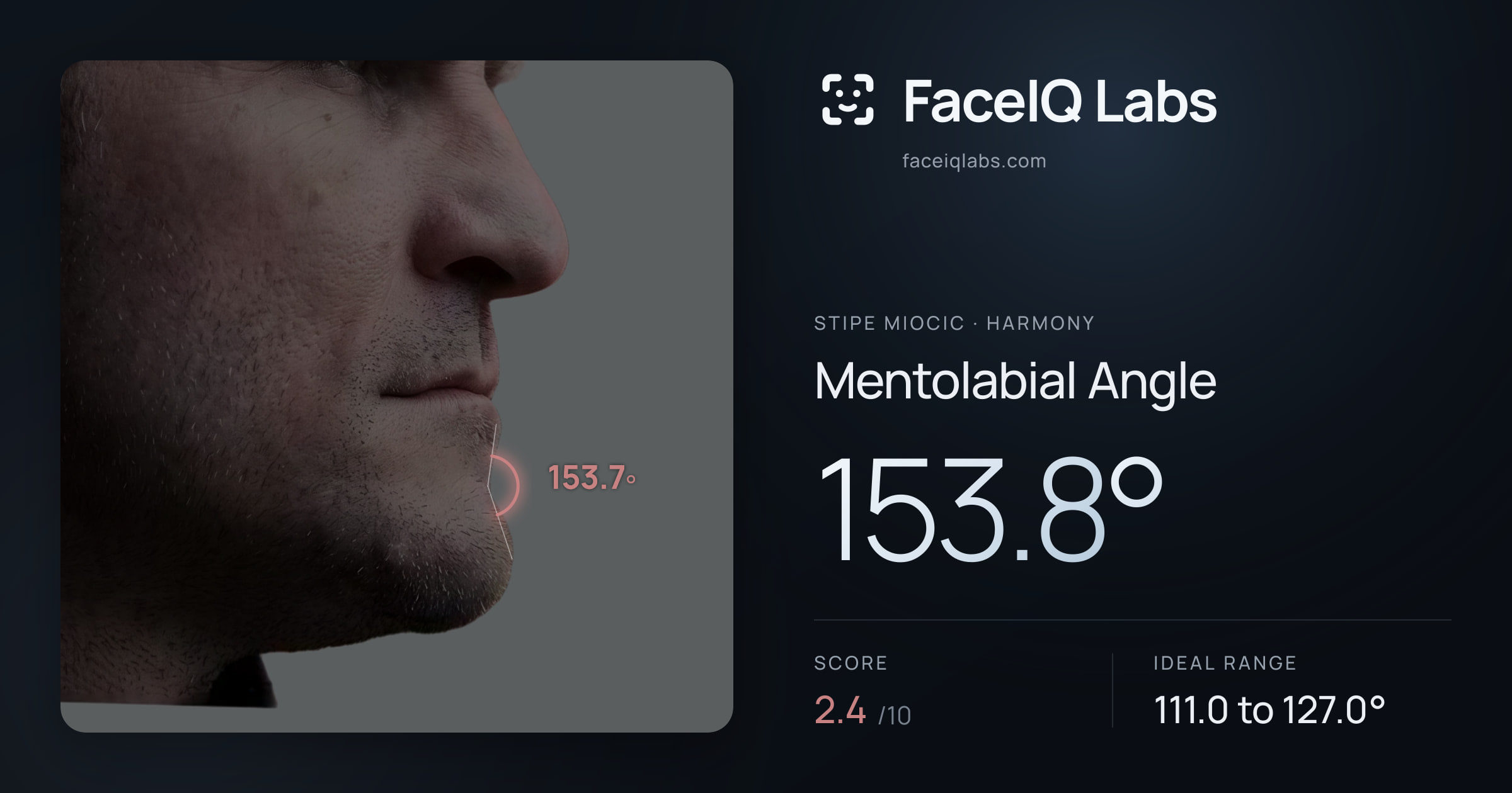Stipe Miocic Mentolabial Angle: 153.8°, drawn on the photo