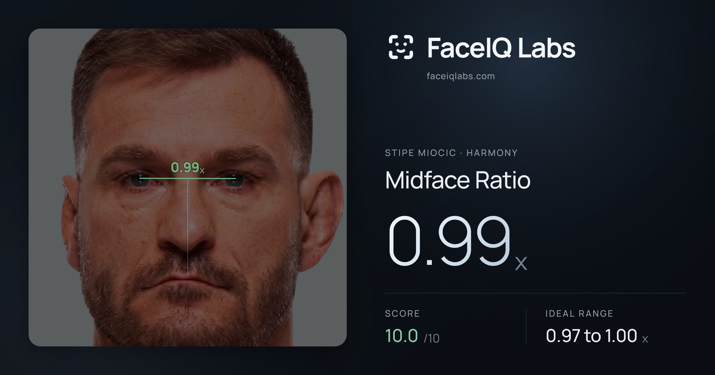 Stipe Miocic Midface Ratio: 0.99x, drawn on the photo