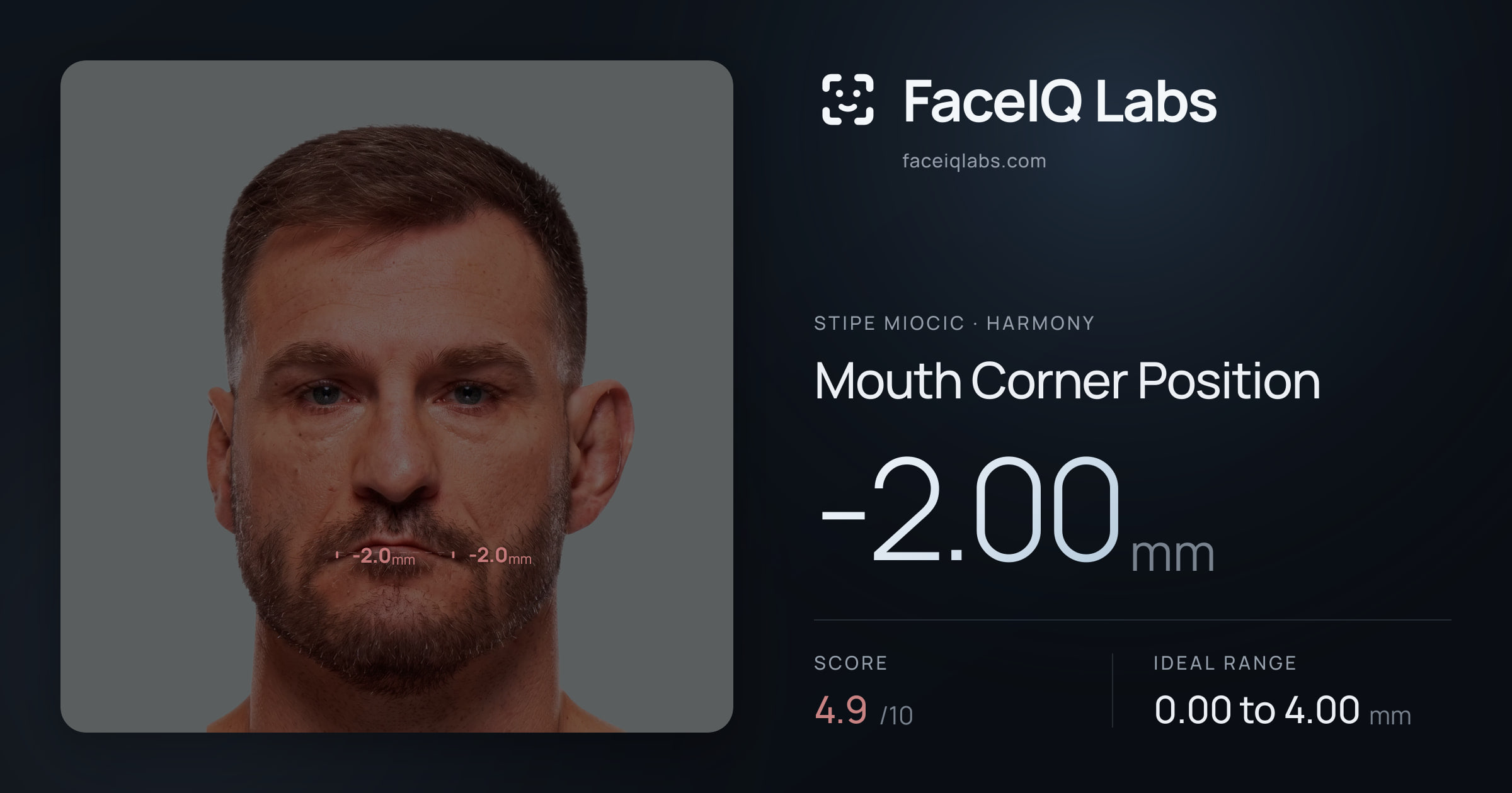 Stipe Miocic Mouth Corner Position: -2.00mm, drawn on the photo