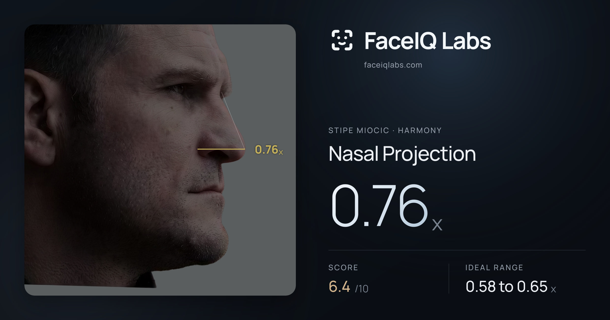 Stipe Miocic Nasal Projection: 0.76x, drawn on the photo