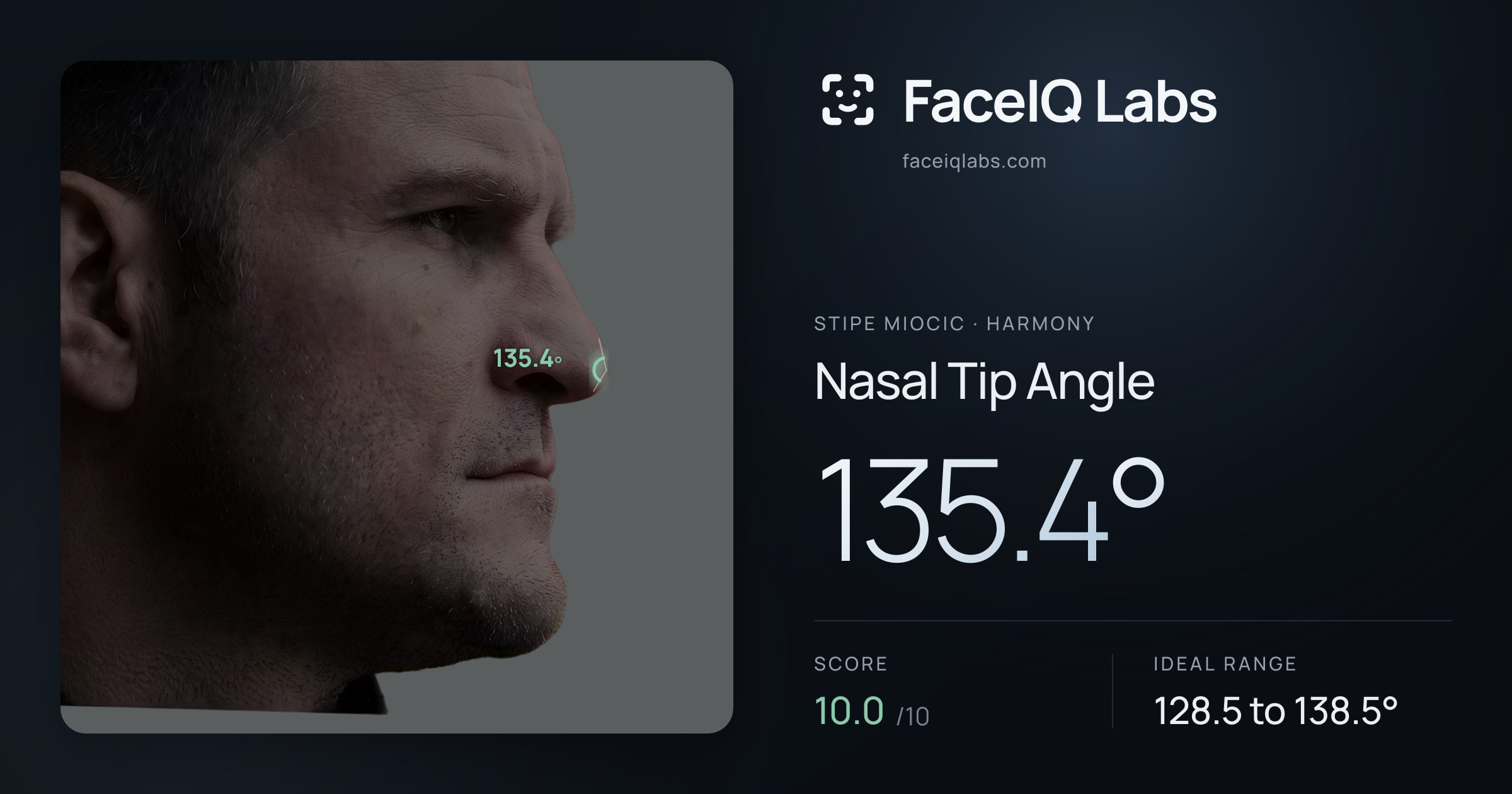 Stipe Miocic Nasal Tip Angle: 135.4°, drawn on the photo