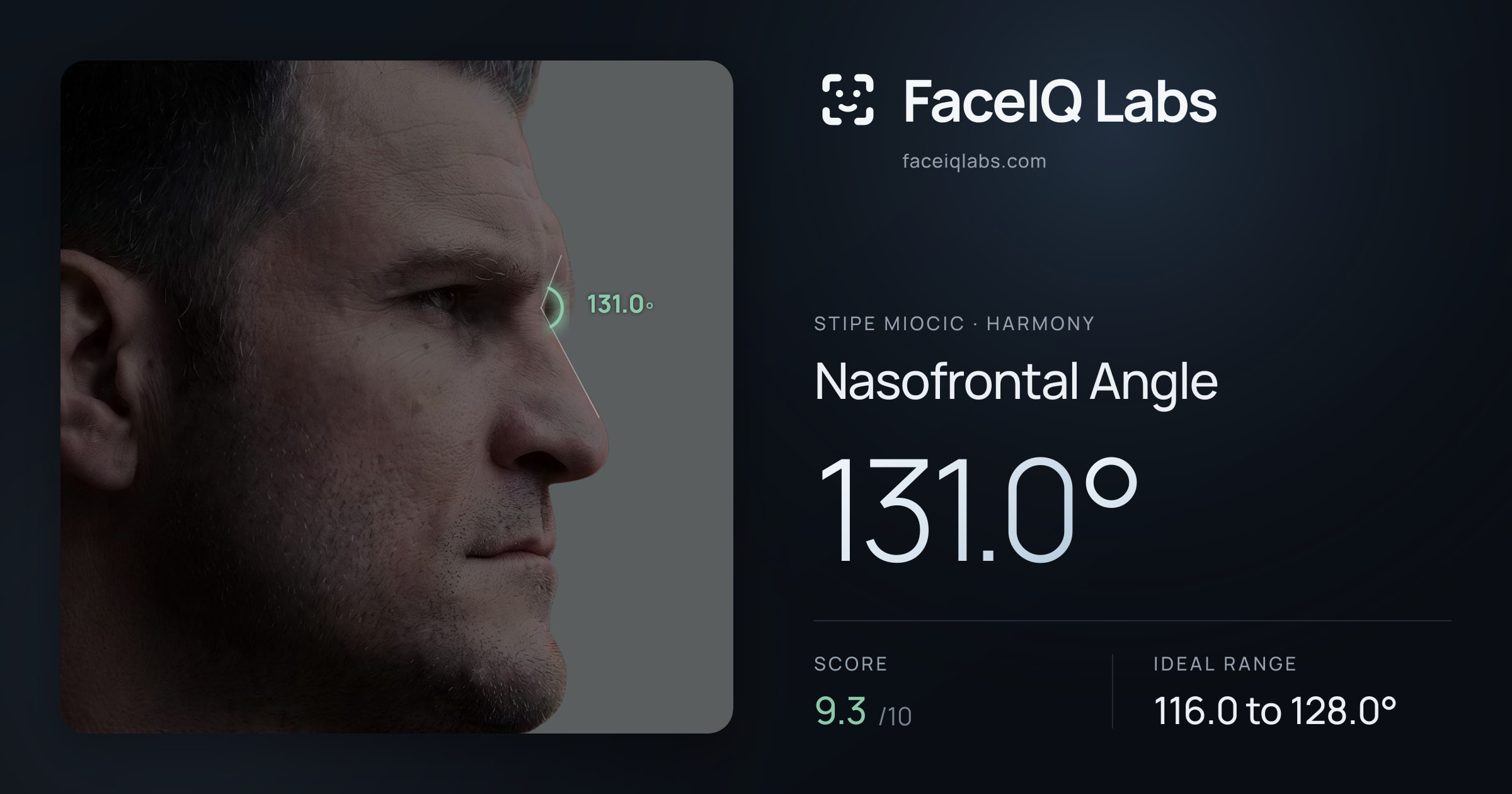 Stipe Miocic Nasofrontal Angle: 131.0°, drawn on the photo