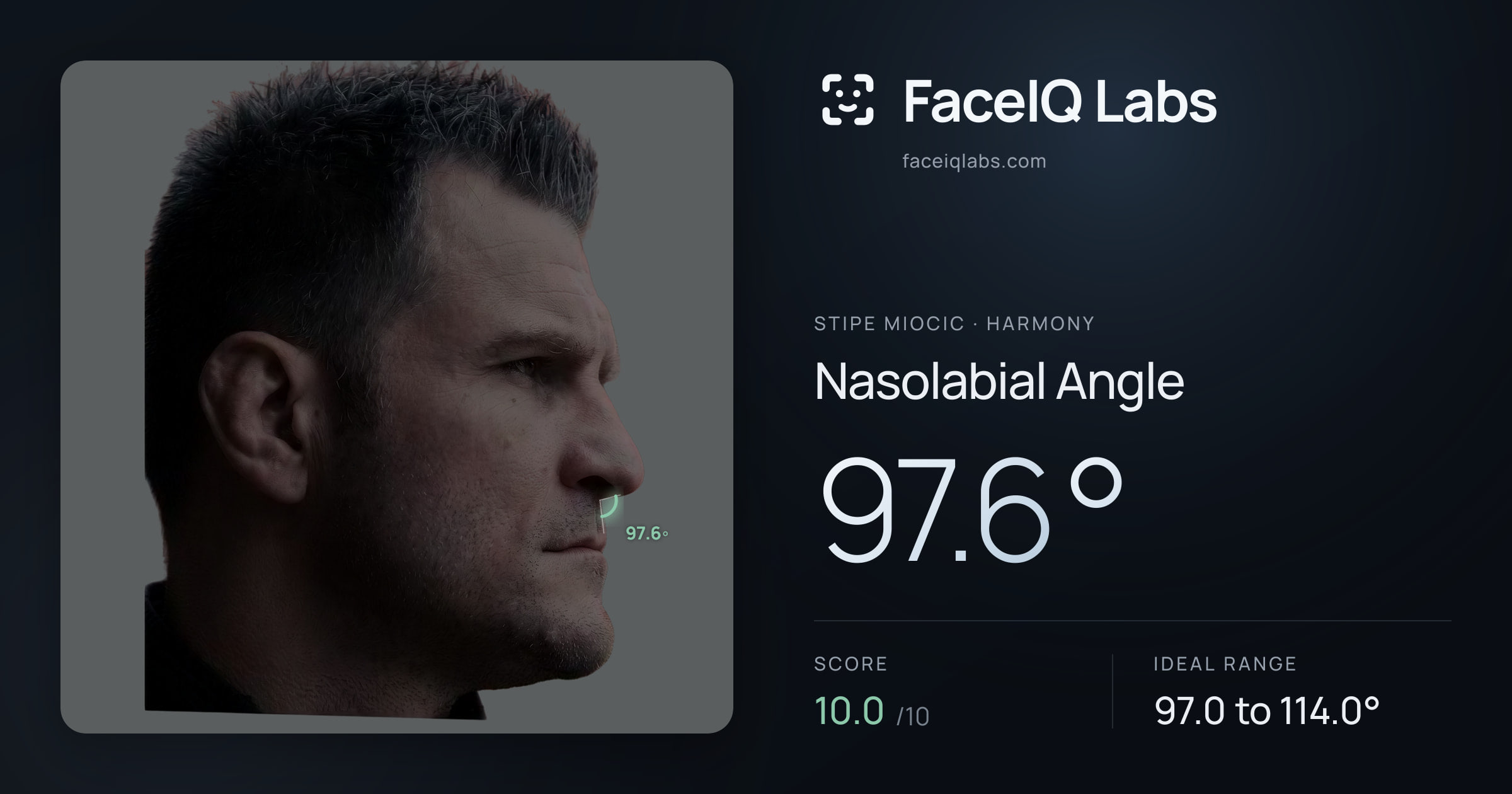 Stipe Miocic Nasolabial Angle: 97.6°, drawn on the photo