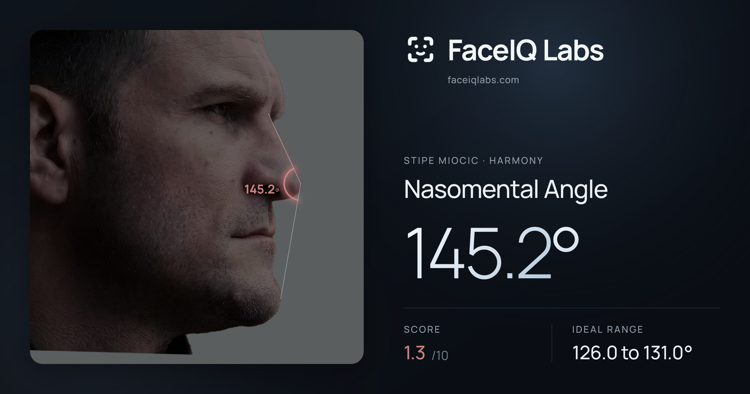 Stipe Miocic Nasomental Angle: 145.2°, drawn on the photo