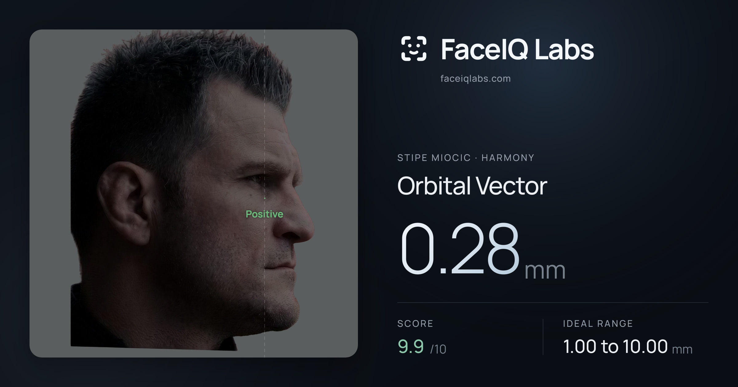 Stipe Miocic Orbital Vector: 0.28mm, drawn on the photo