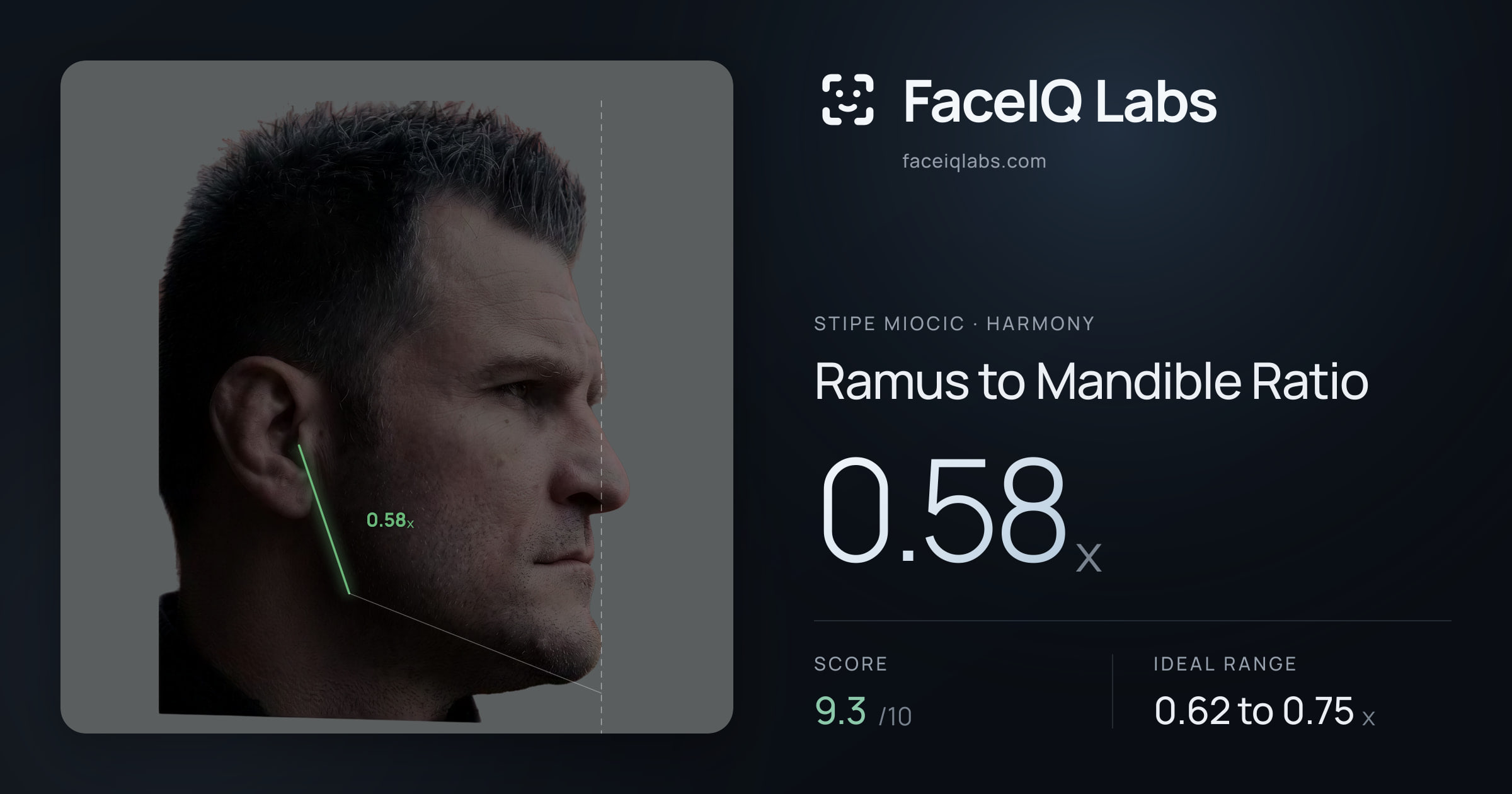 Stipe Miocic Ramus to Mandible Ratio: 0.58x, drawn on the photo