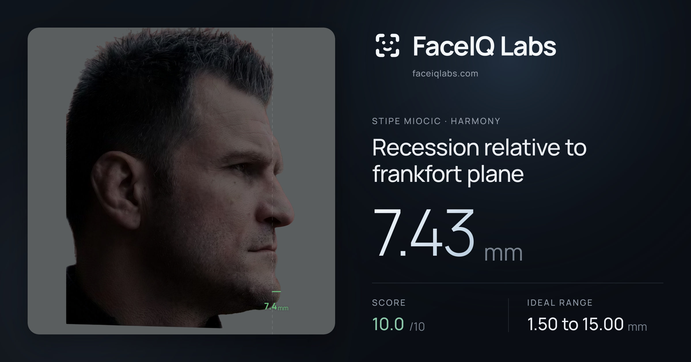 Stipe Miocic Recession relative to frankfort plane: 7.43mm, drawn on the photo