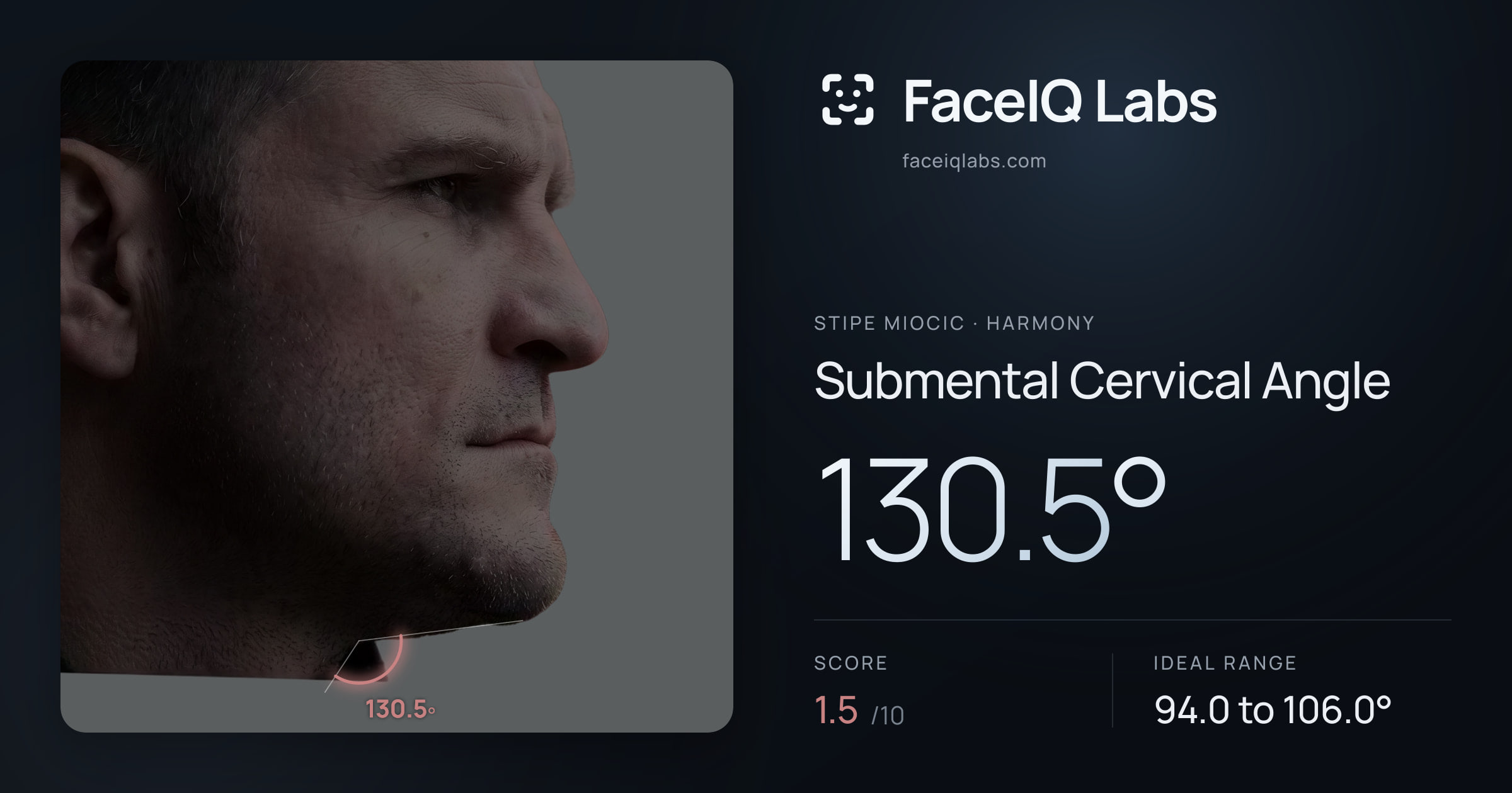 Stipe Miocic Submental Cervical Angle: 130.5°, drawn on the photo