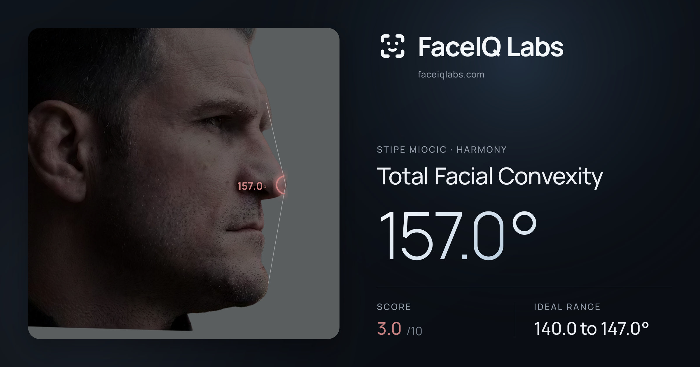 Stipe Miocic Total Facial Convexity: 157.0°, drawn on the photo
