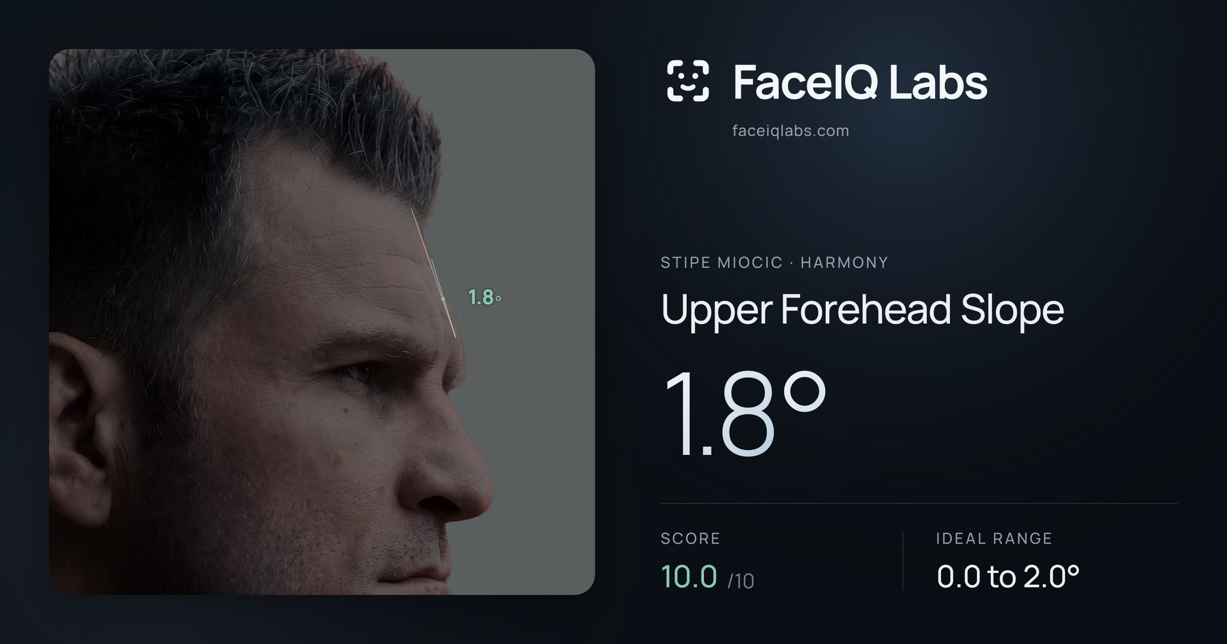Stipe Miocic Upper Forehead Slope: 1.8°, drawn on the photo