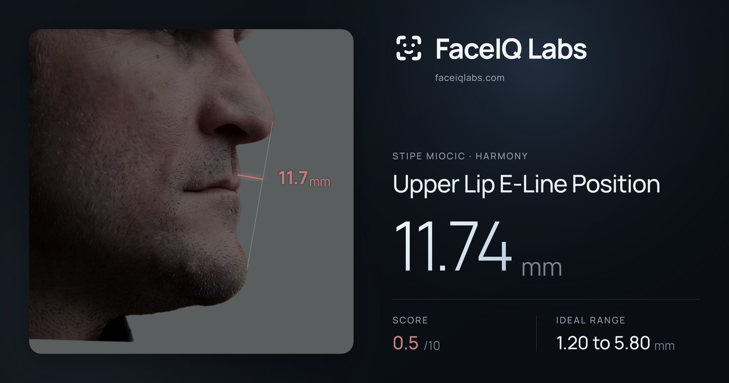 Stipe Miocic Upper Lip E-Line Position: 11.74mm, drawn on the photo