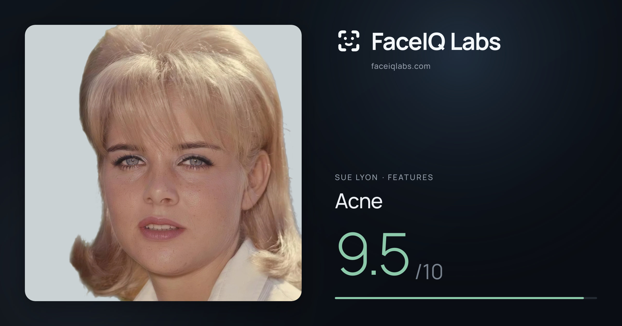 Sue Lyon Acne: 9.5/10, drawn on the photo