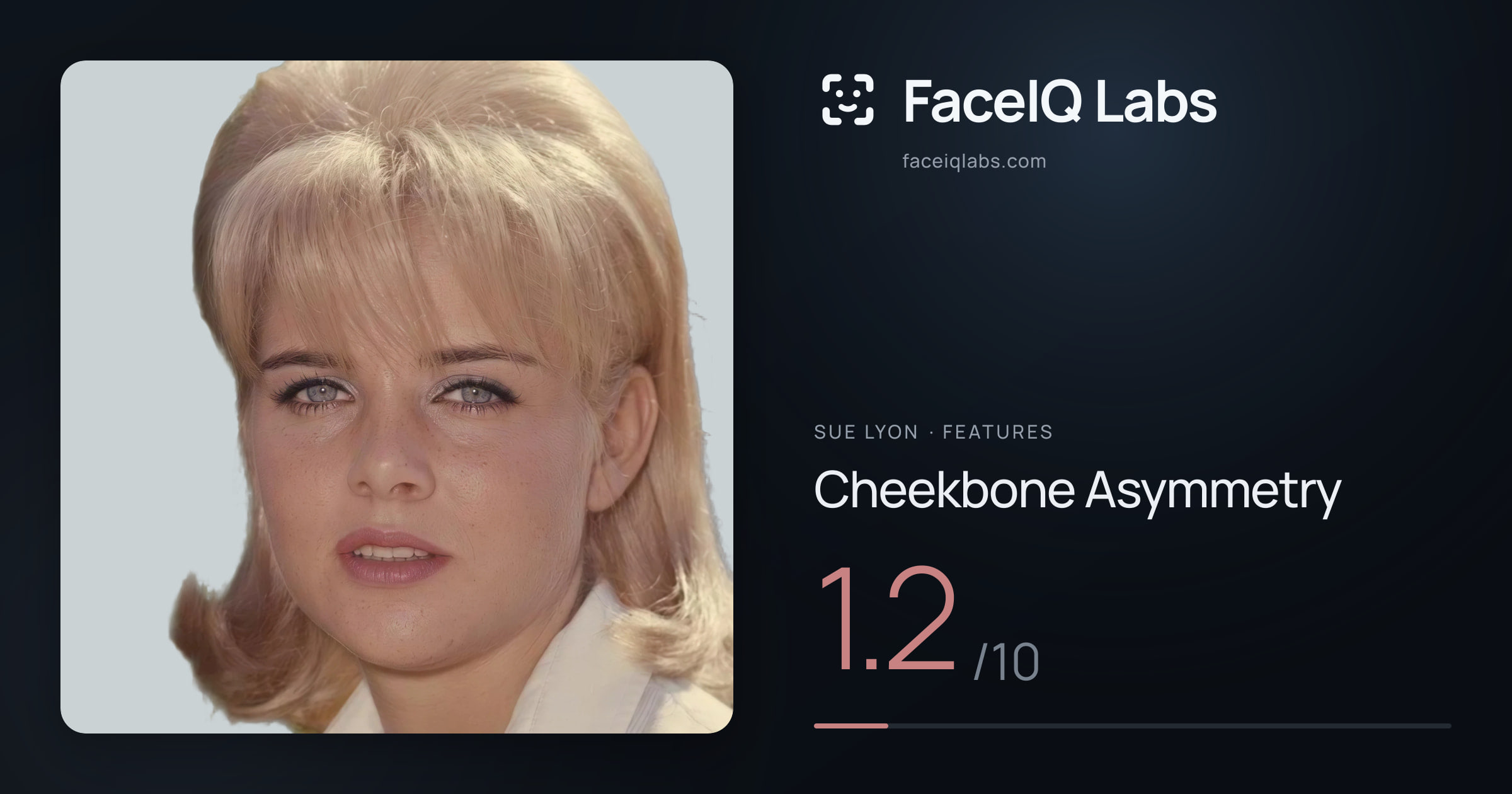 Sue Lyon Cheekbone Asymmetry: 1.2/10, drawn on the photo
