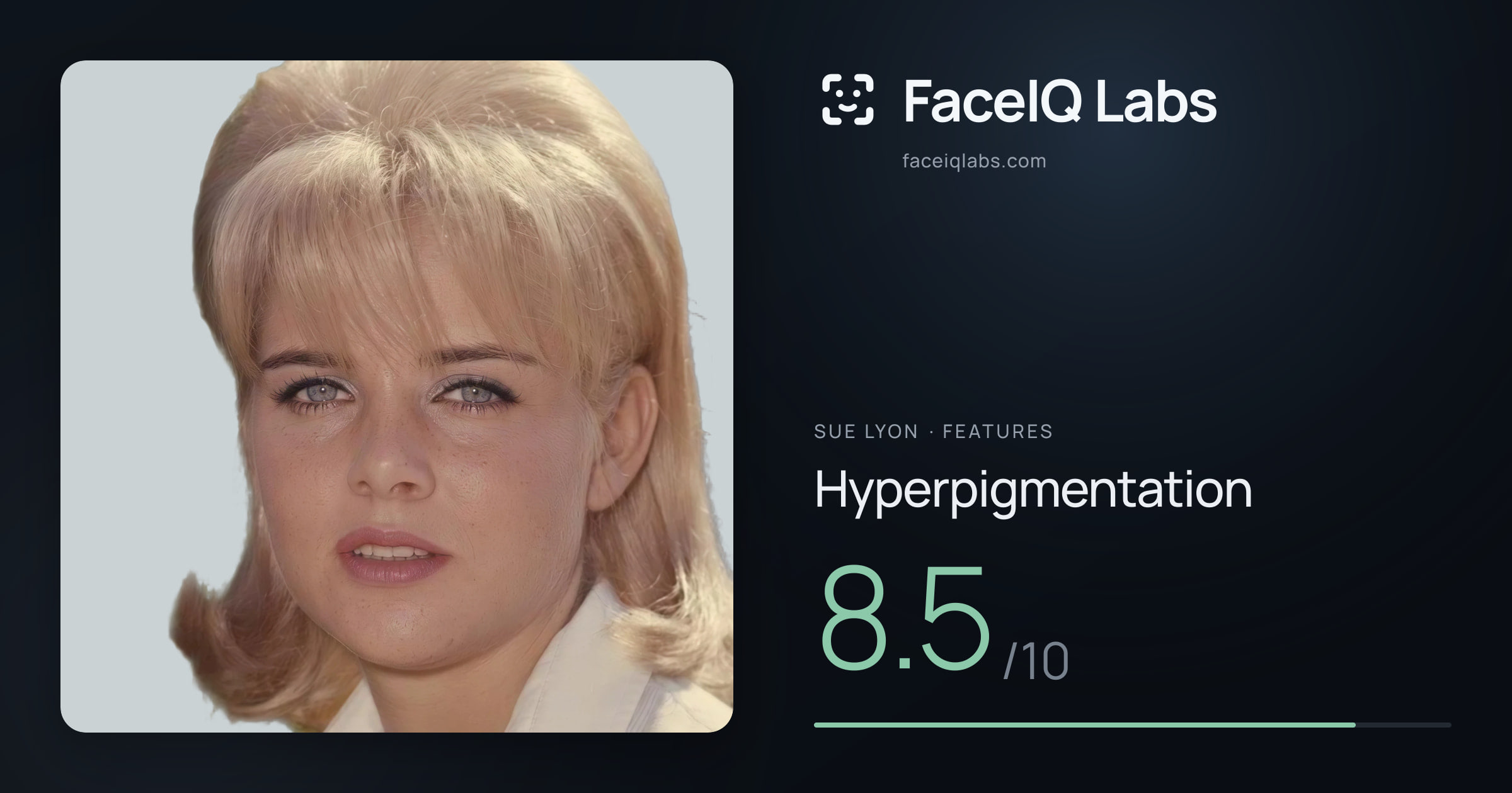 Sue Lyon Hyperpigmentation: 8.5/10, drawn on the photo