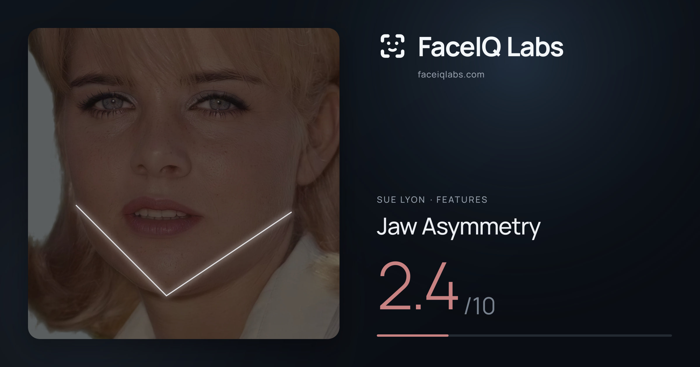 Sue Lyon Jaw Asymmetry: 2.4/10, drawn on the photo