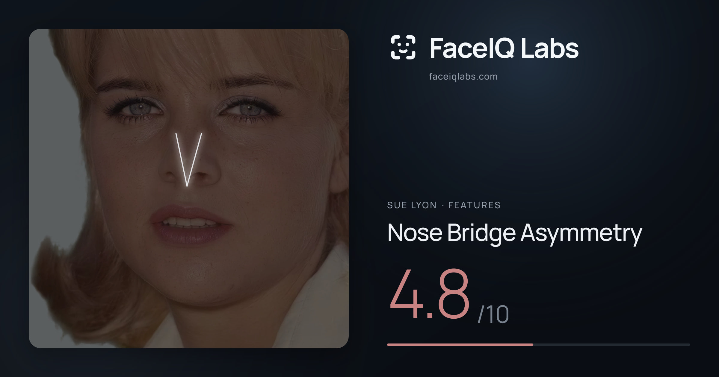Sue Lyon Nose Bridge Asymmetry: 4.8/10, drawn on the photo