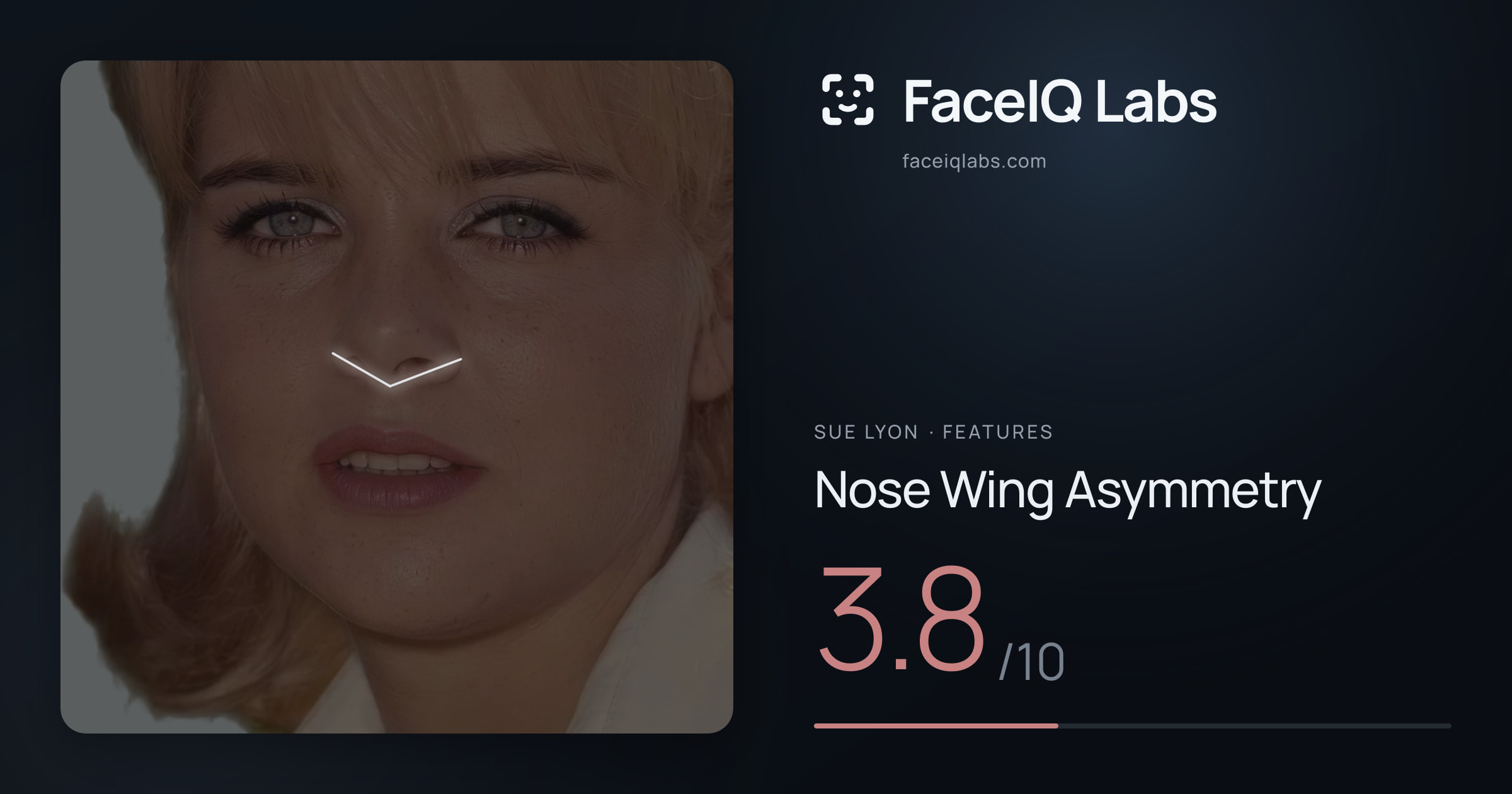 Sue Lyon Nose Wing Asymmetry: 3.8/10, drawn on the photo