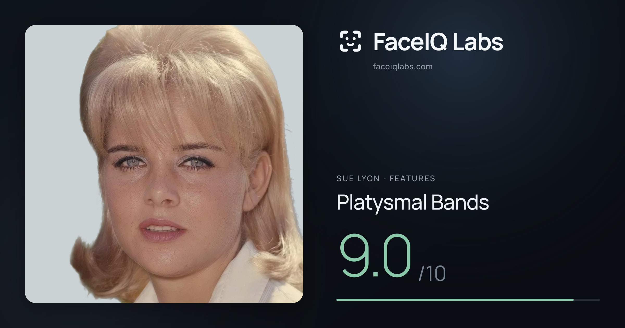 Sue Lyon Platysmal Bands: 9.0/10, drawn on the photo