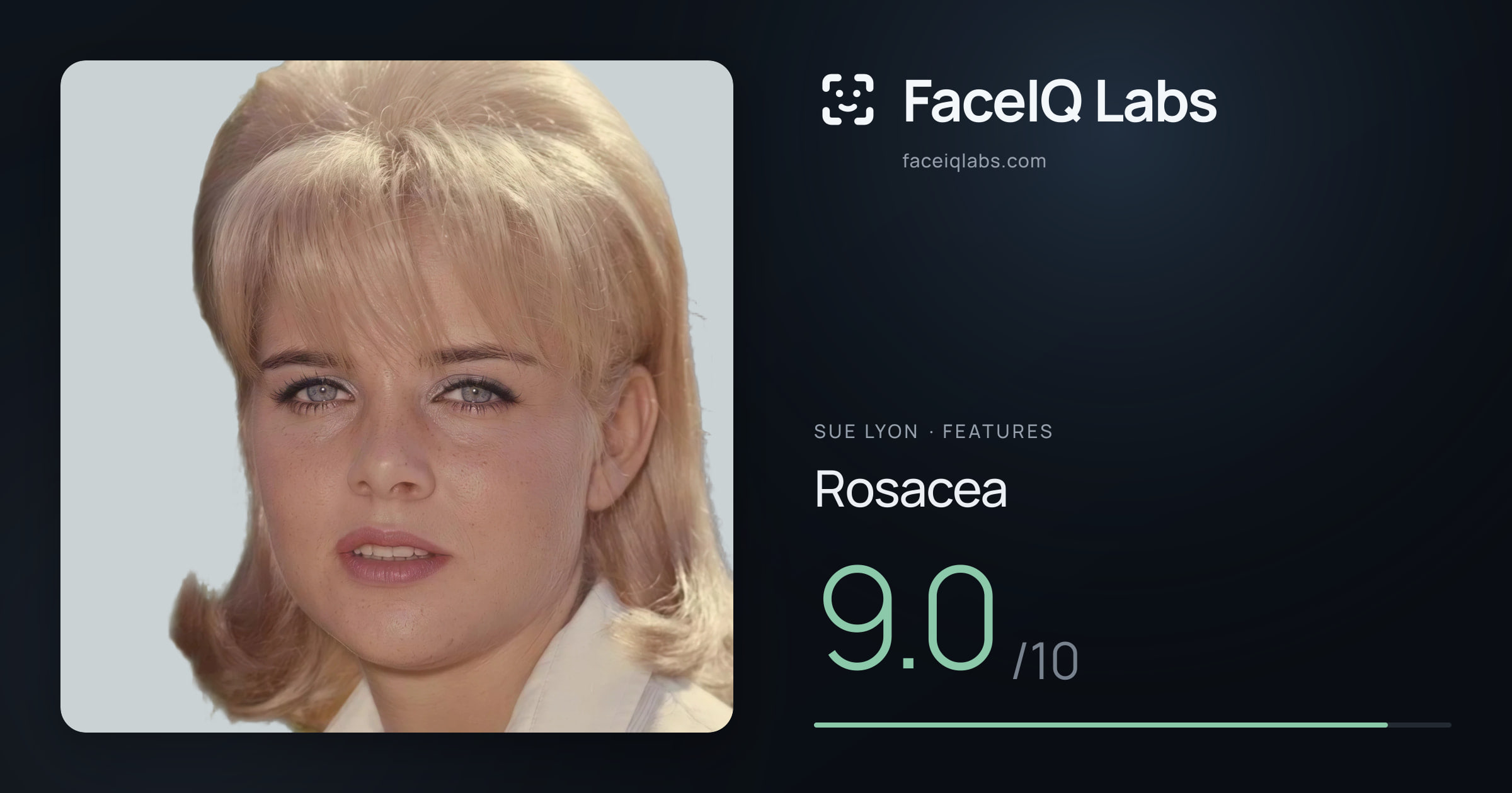 Sue Lyon Rosacea: 9.0/10, drawn on the photo