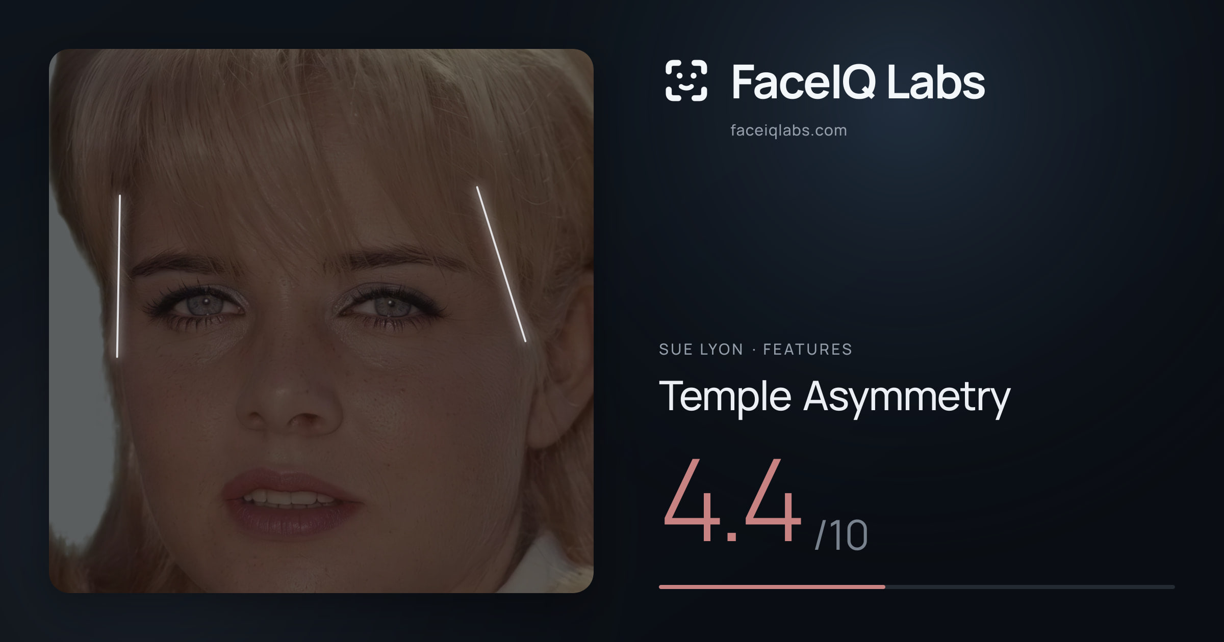 Sue Lyon Temple Asymmetry: 4.4/10, drawn on the photo