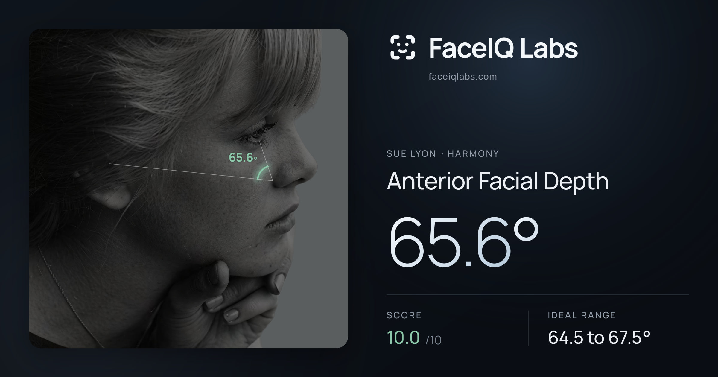 Sue Lyon Anterior Facial Depth: 65.6°, drawn on the photo