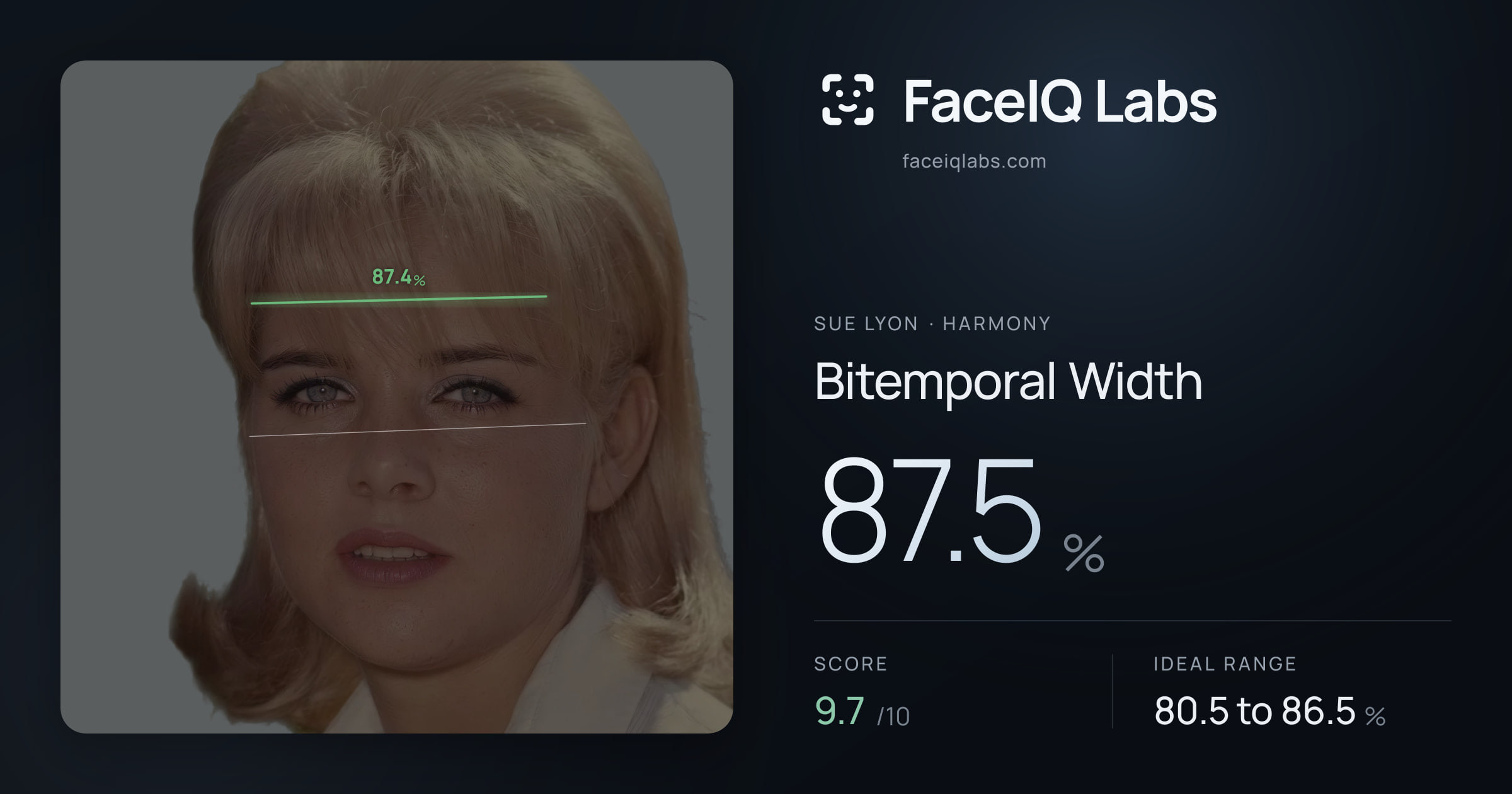 Sue Lyon Bitemporal Width: 87.5%, drawn on the photo