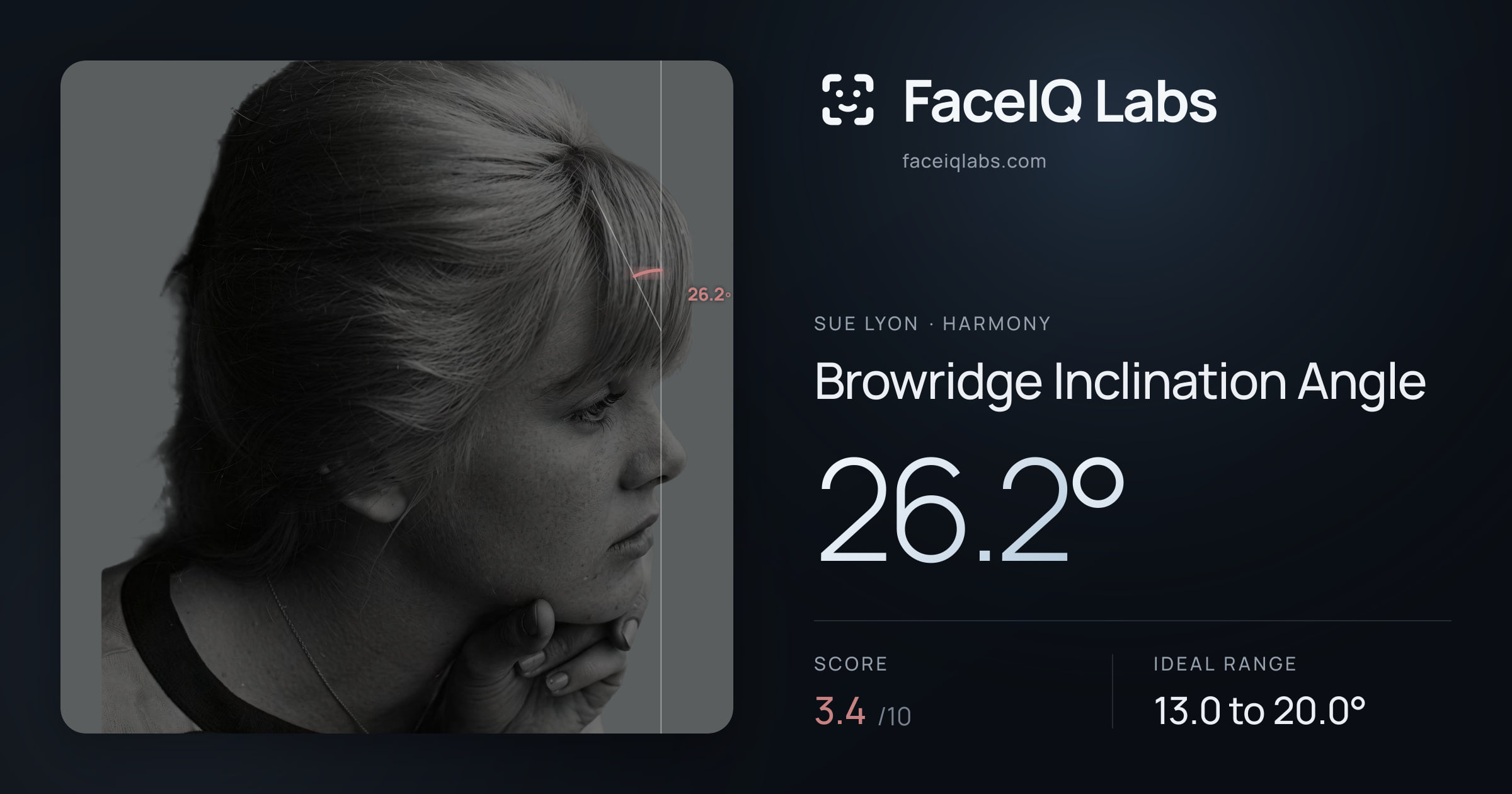 Sue Lyon Browridge Inclination Angle: 26.2°, drawn on the photo