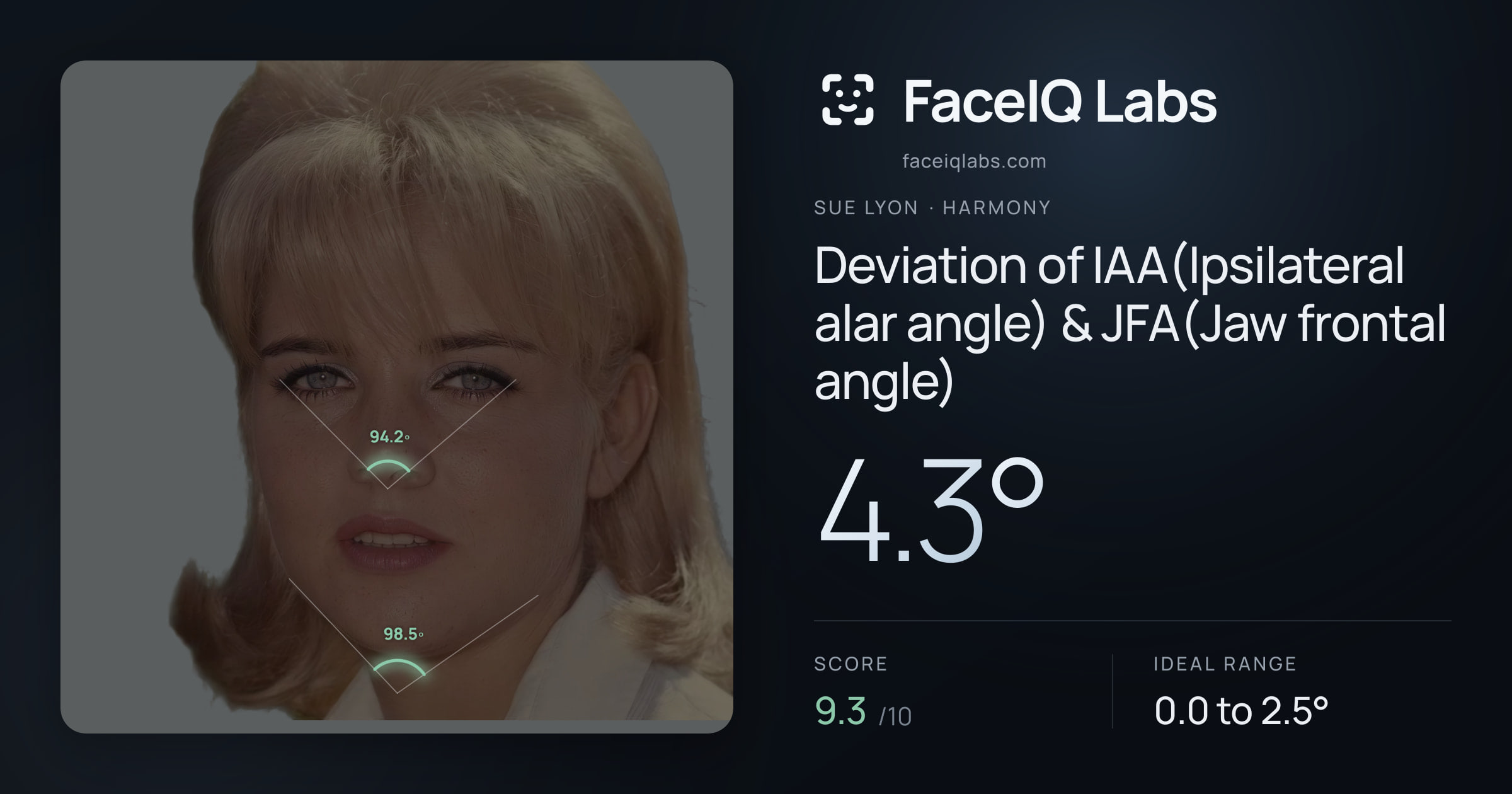 Sue Lyon Deviation of IAA(Ipsilateral alar angle) & JFA(Jaw frontal angle): 4.3°, drawn on the photo