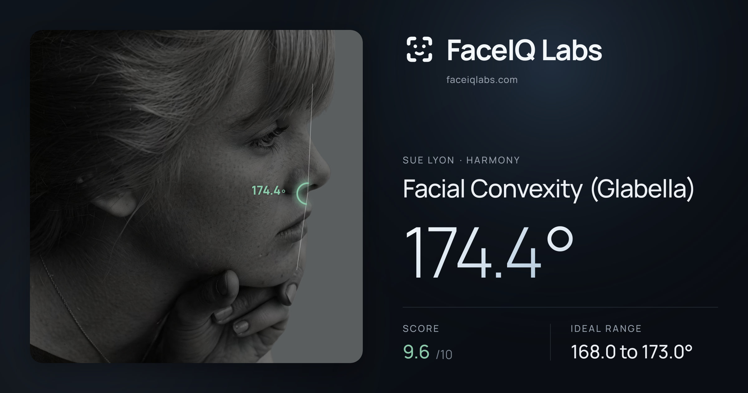 Sue Lyon Facial Convexity (Glabella): 174.4°, drawn on the photo