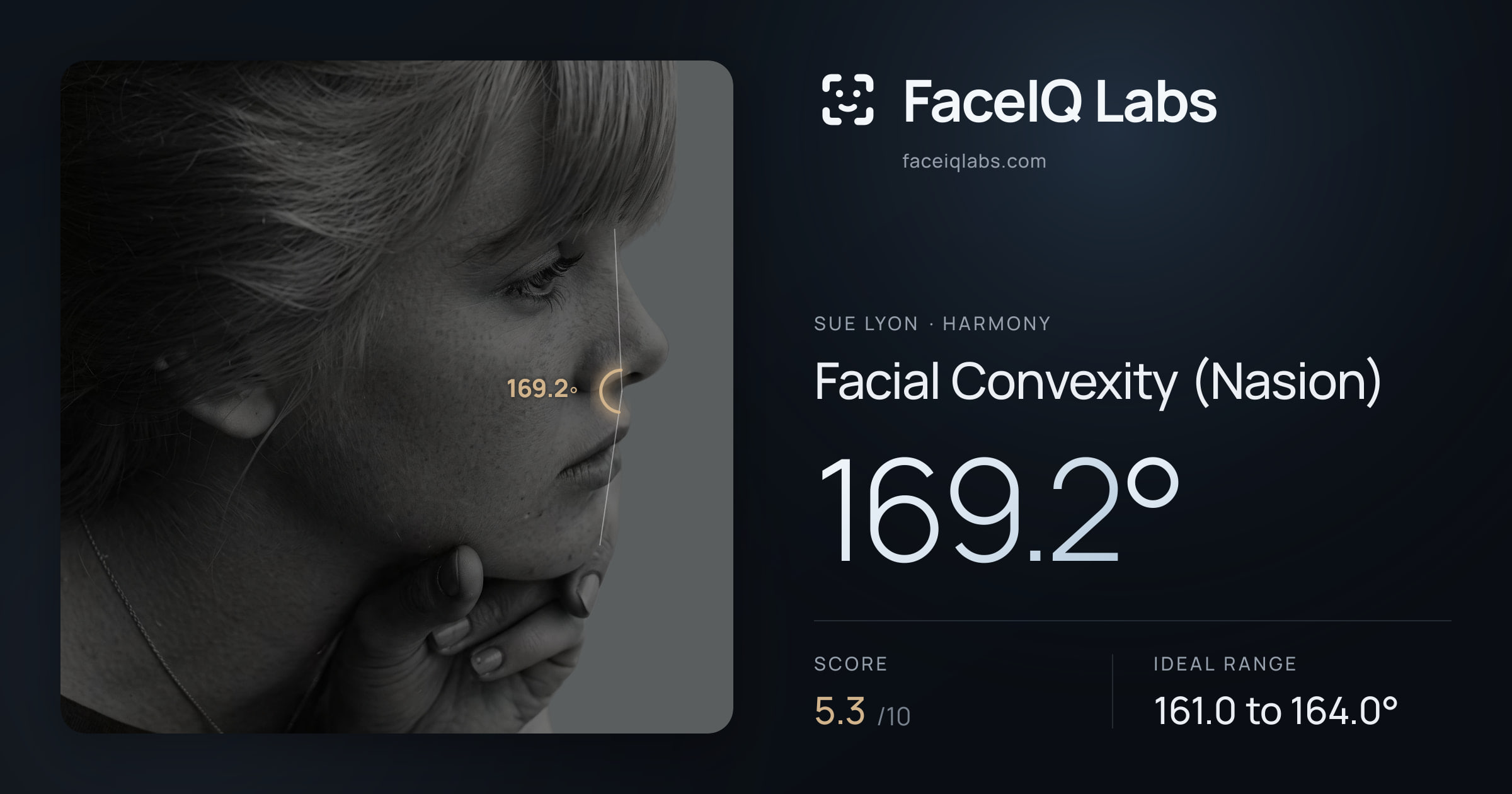 Sue Lyon Facial Convexity (Nasion): 169.2°, drawn on the photo