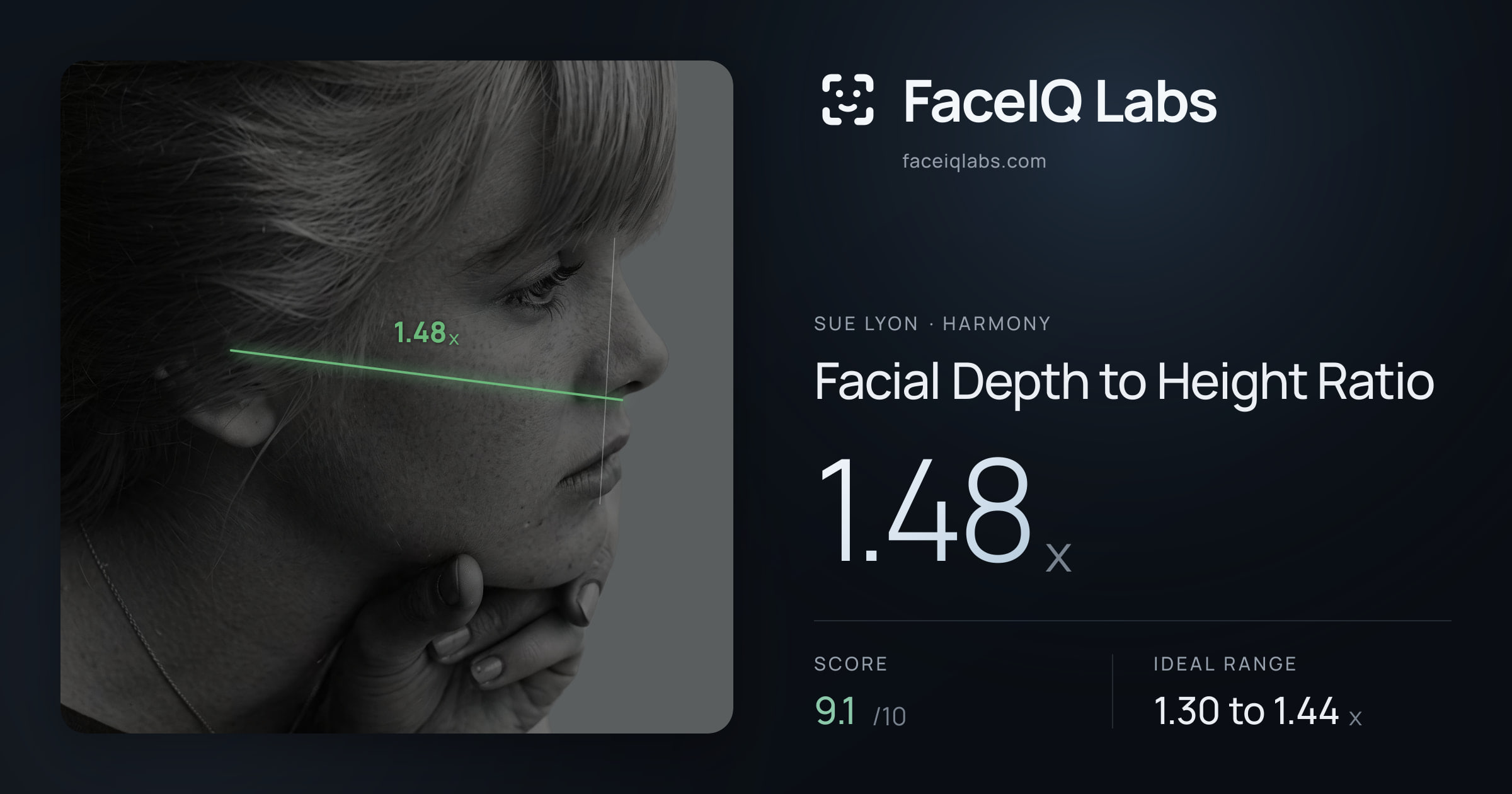 Sue Lyon Facial Depth to Height Ratio: 1.48x, drawn on the photo