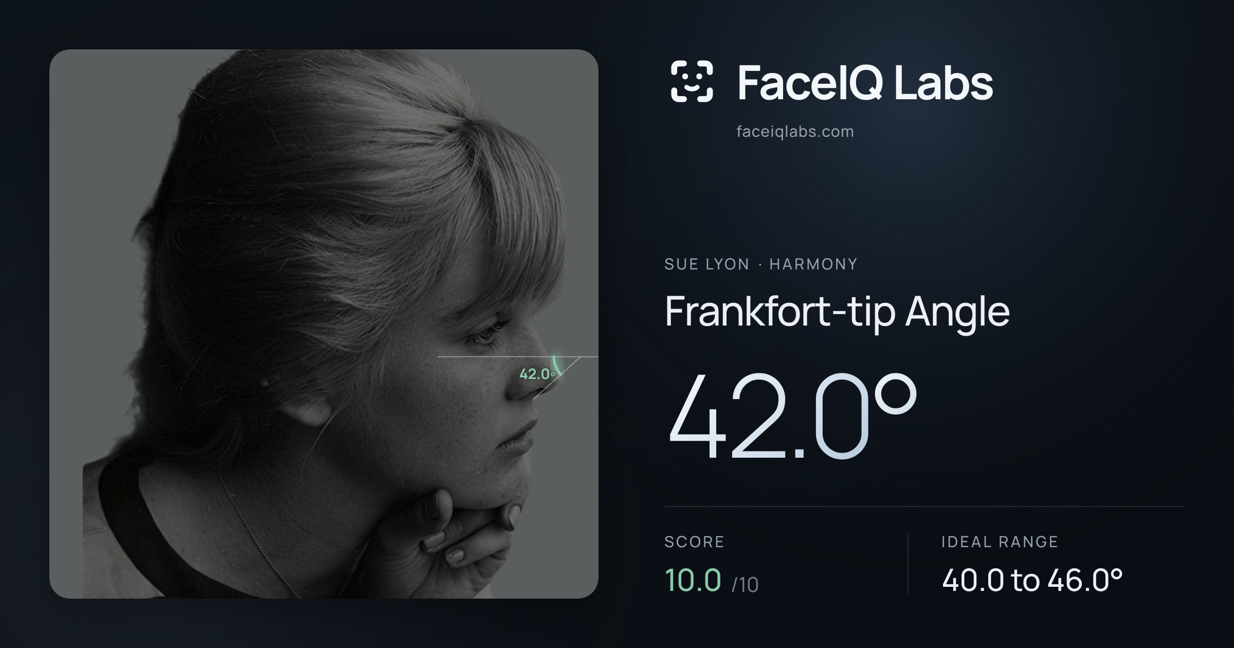 Sue Lyon Frankfort-tip Angle: 42.0°, drawn on the photo