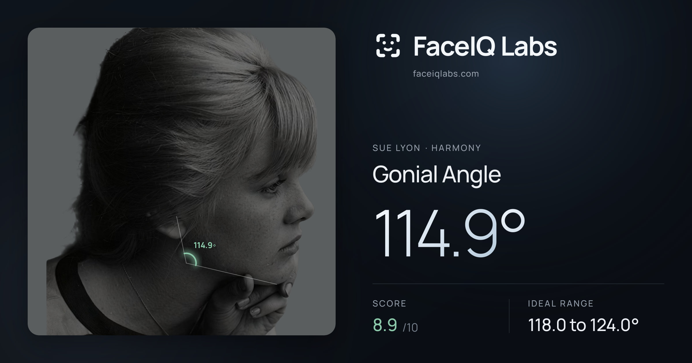 Sue Lyon Gonial Angle: 114.9°, drawn on the photo