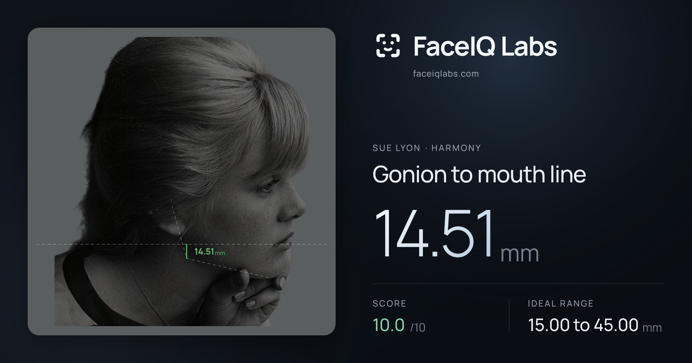 Sue Lyon Gonion to mouth line: 14.51mm, drawn on the photo