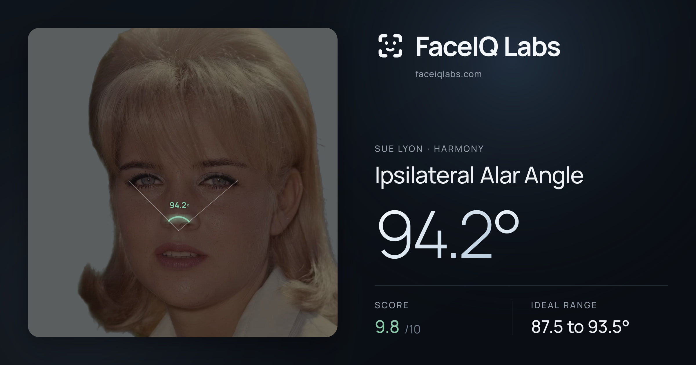 Sue Lyon Ipsilateral Alar Angle: 94.2°, drawn on the photo