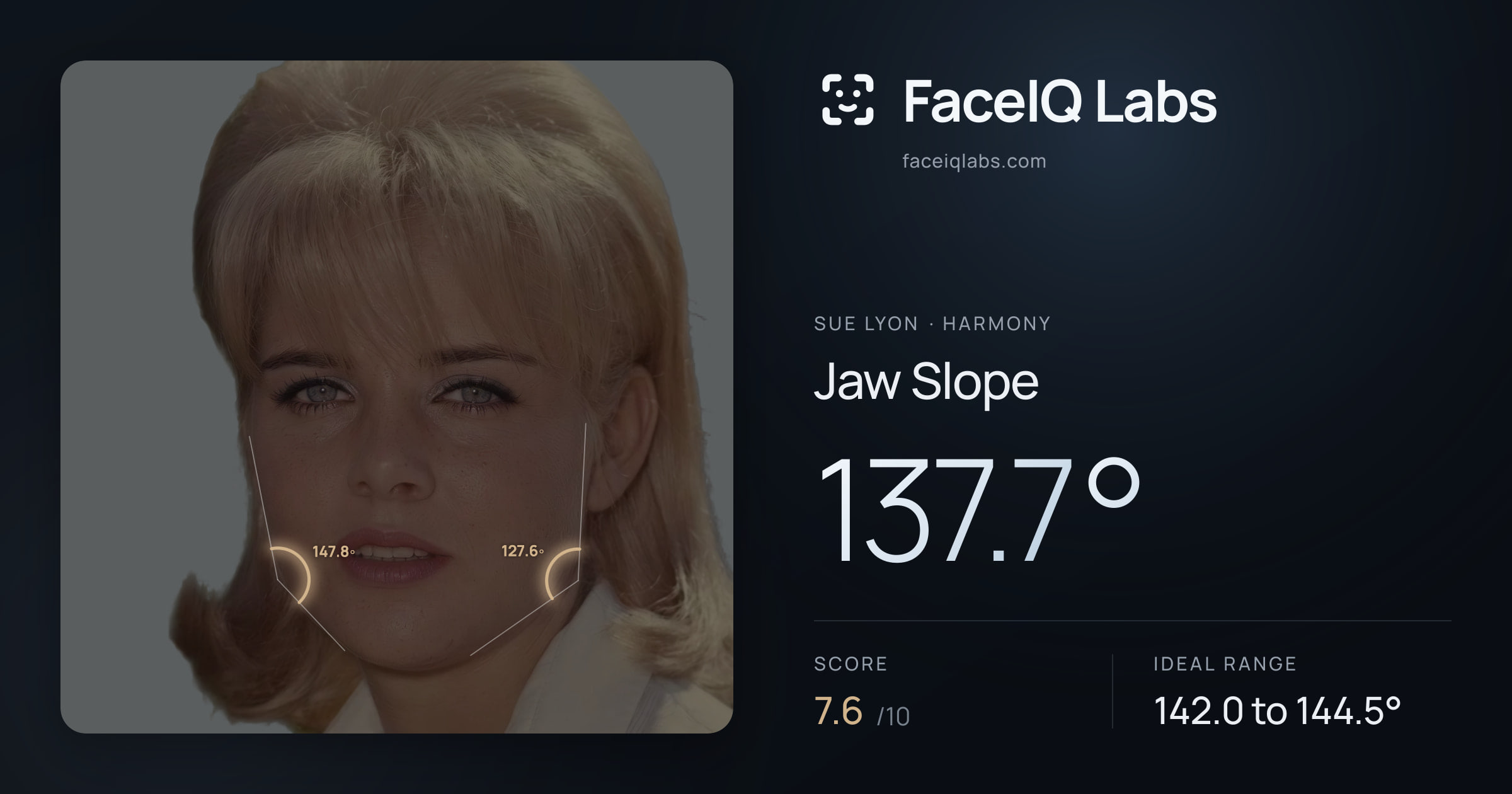 Sue Lyon Jaw Slope: 137.7°, drawn on the photo
