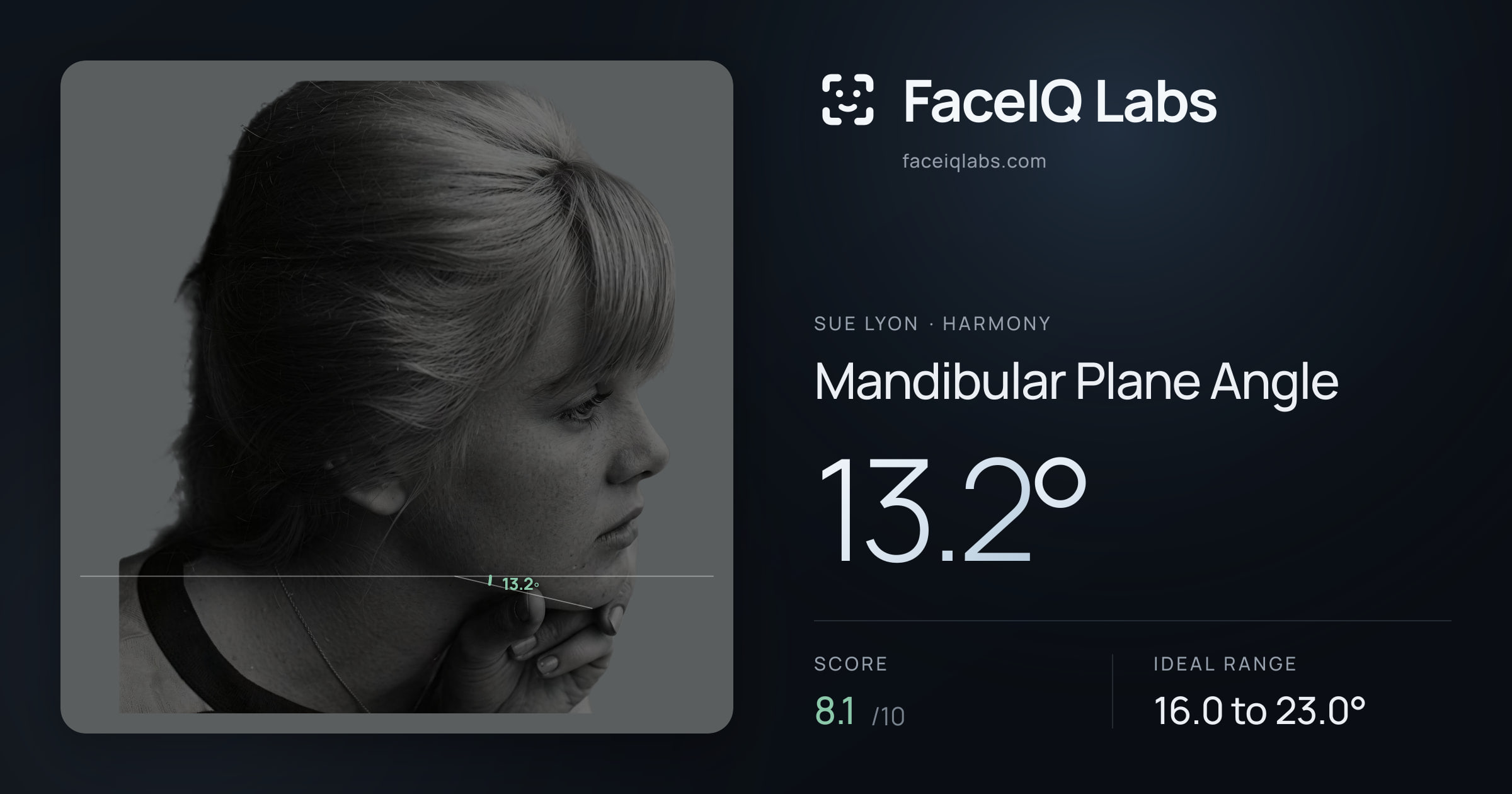 Sue Lyon Mandibular Plane Angle: 13.2°, drawn on the photo