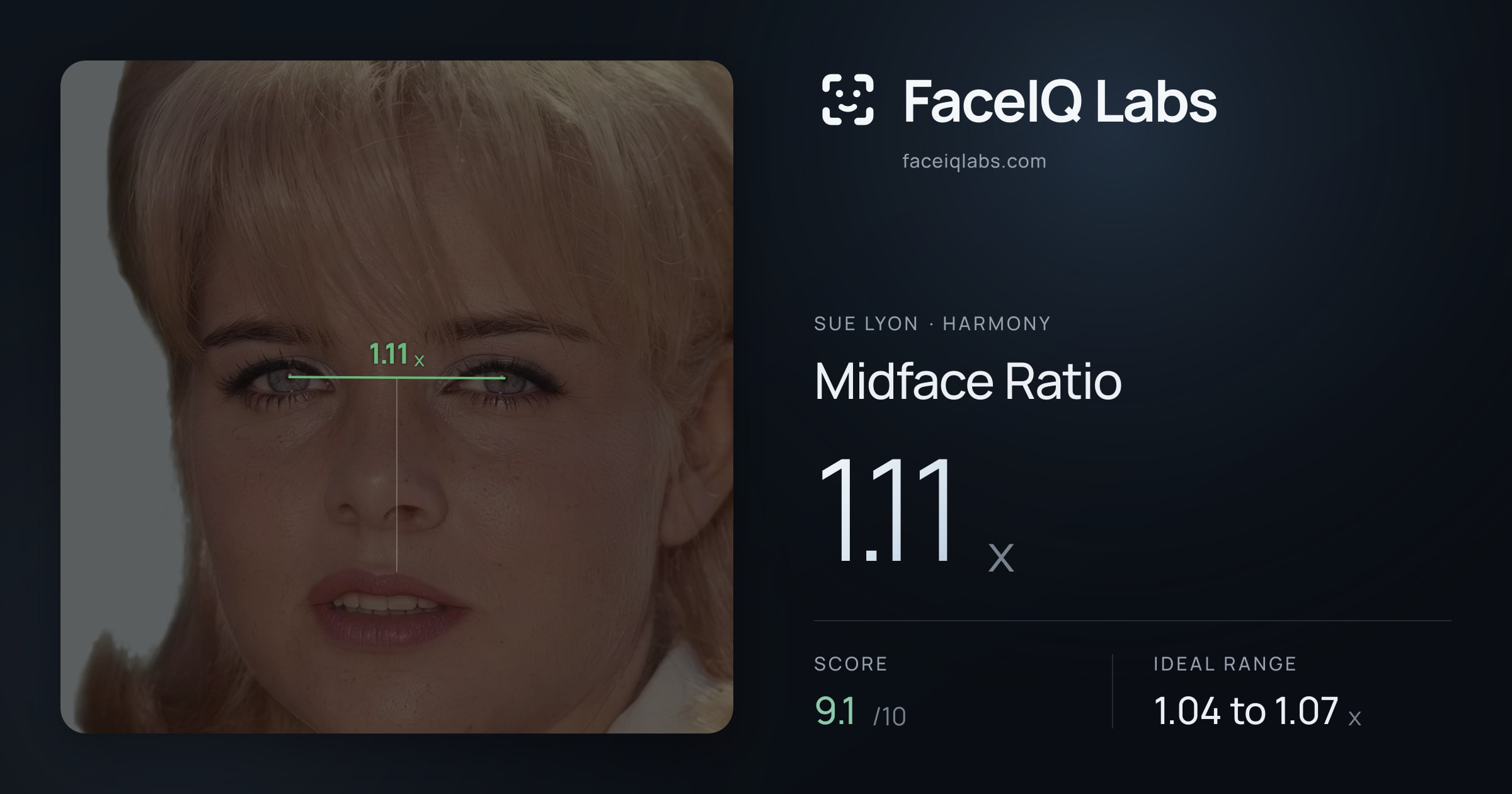 Sue Lyon Midface Ratio: 1.11x, drawn on the photo
