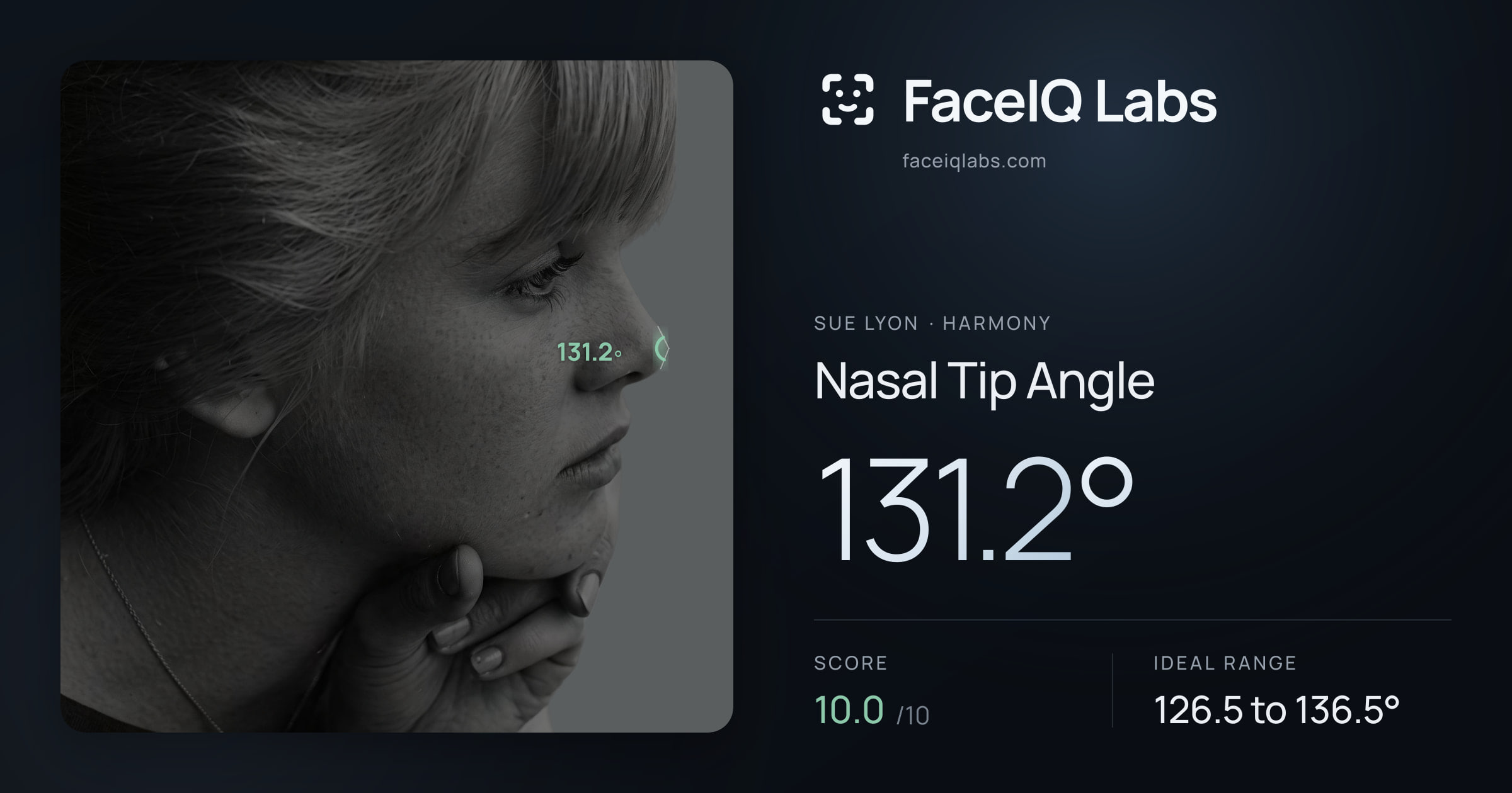 Sue Lyon Nasal Tip Angle: 131.2°, drawn on the photo