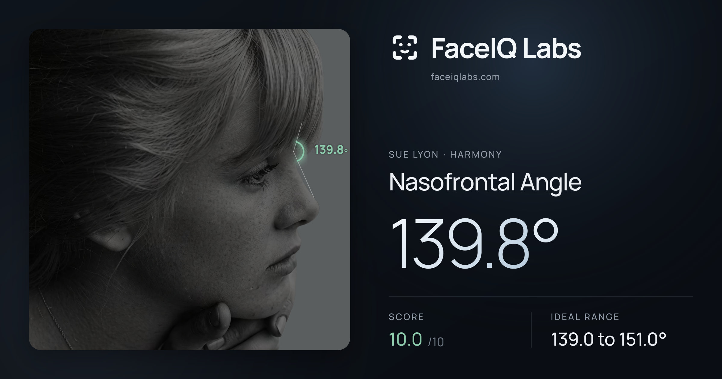 Sue Lyon Nasofrontal Angle: 139.8°, drawn on the photo