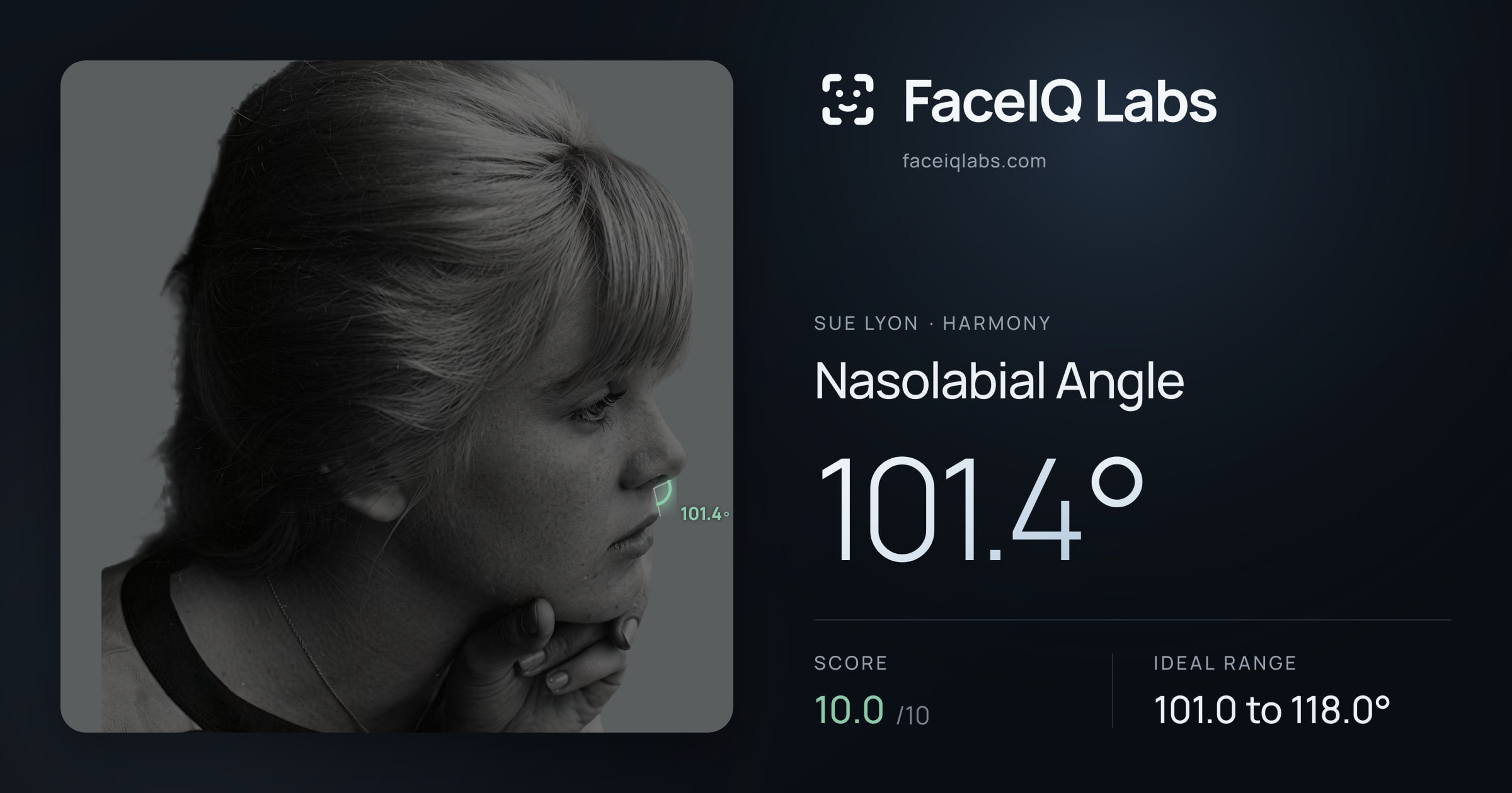 Sue Lyon Nasolabial Angle: 101.4°, drawn on the photo