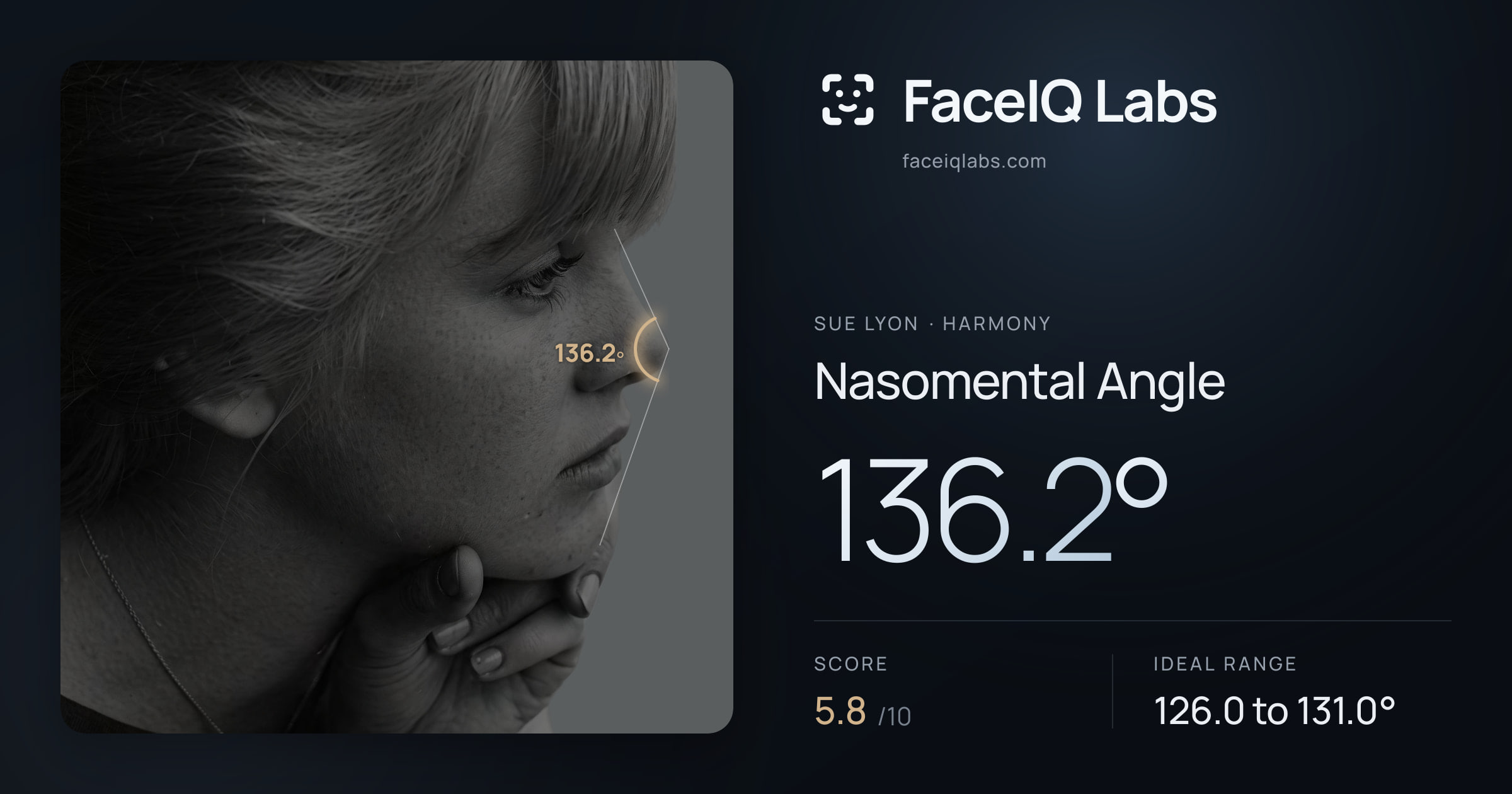 Sue Lyon Nasomental Angle: 136.2°, drawn on the photo