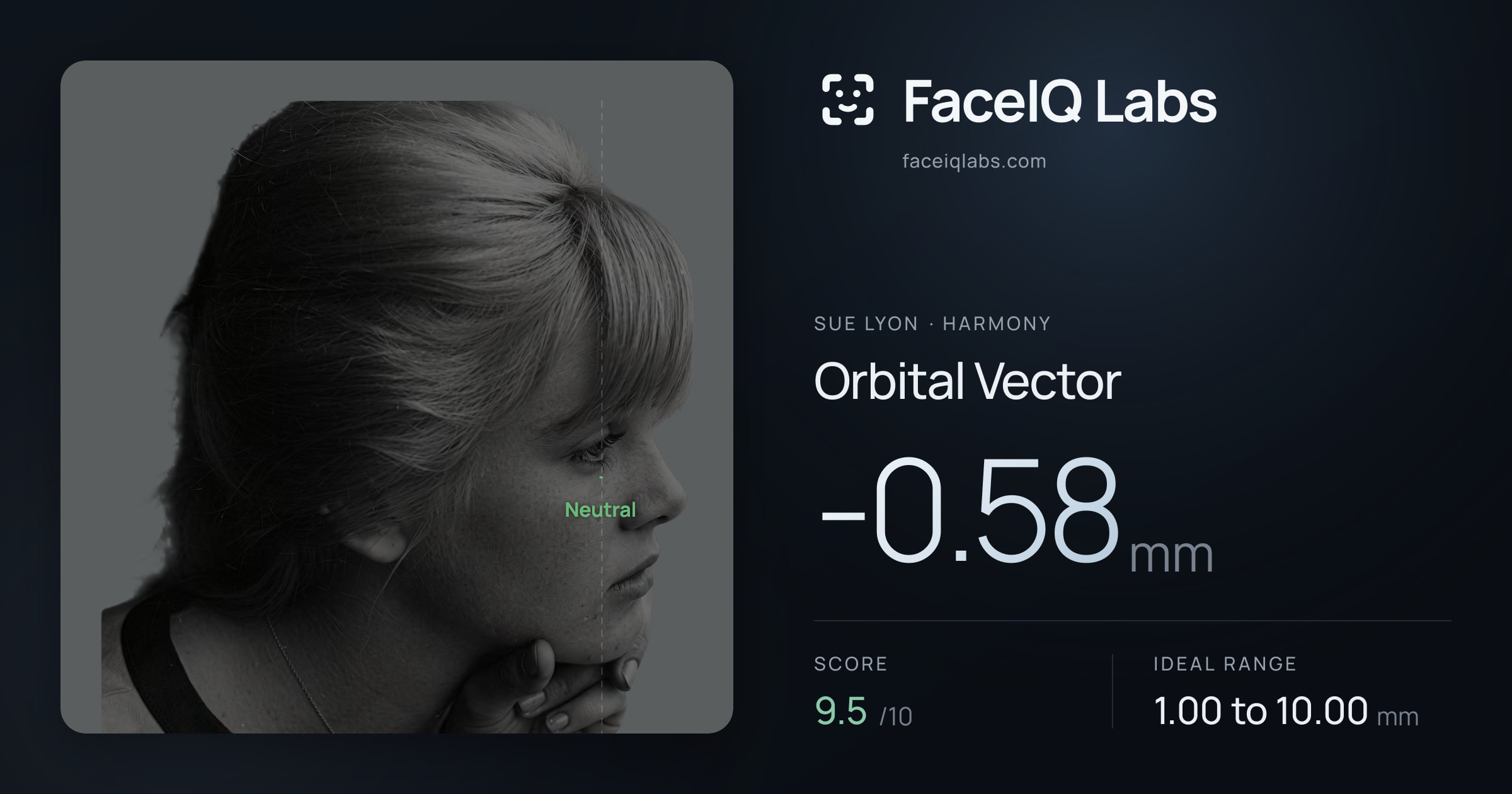 Sue Lyon Orbital Vector: -0.58mm, drawn on the photo