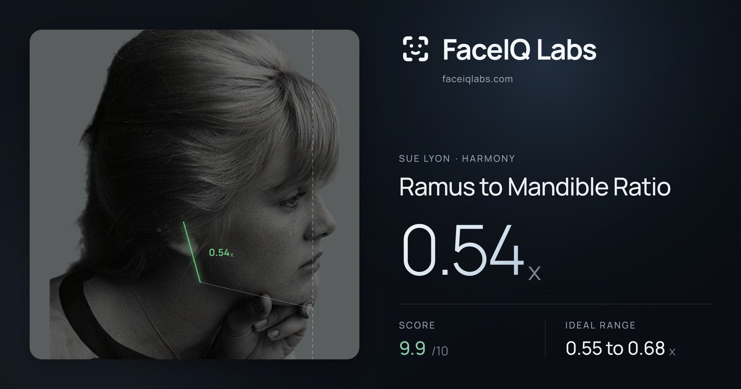 Sue Lyon Ramus to Mandible Ratio: 0.54x, drawn on the photo