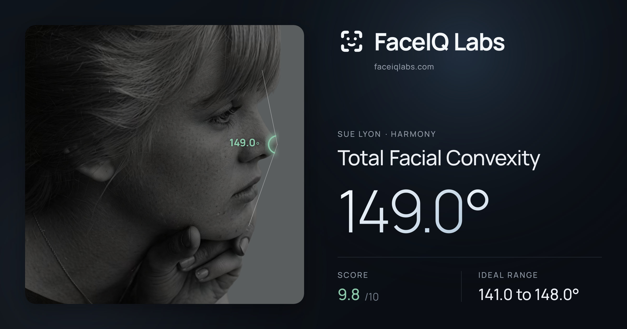 Sue Lyon Total Facial Convexity: 149.0°, drawn on the photo