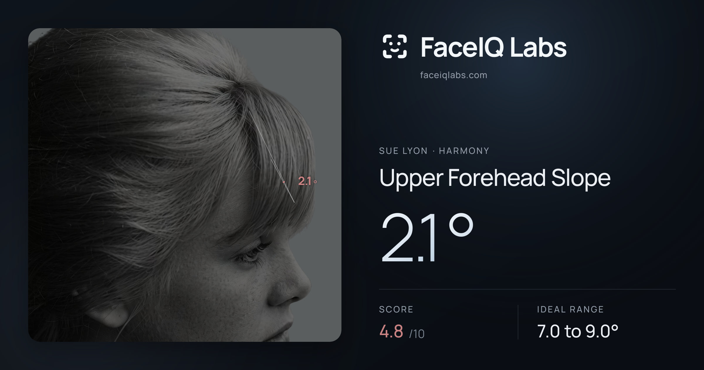 Sue Lyon Upper Forehead Slope: 2.1°, drawn on the photo
