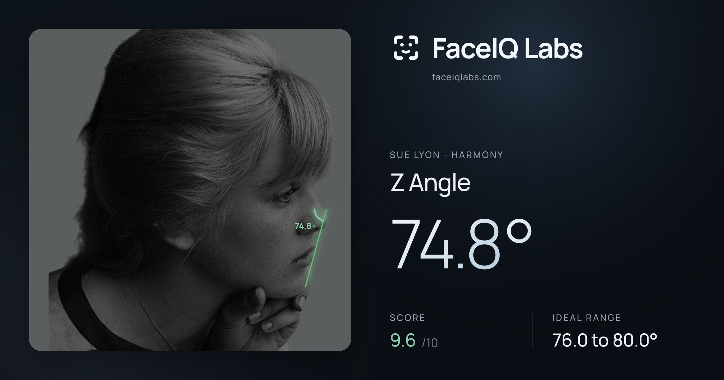 Sue Lyon Z Angle: 74.8°, drawn on the photo