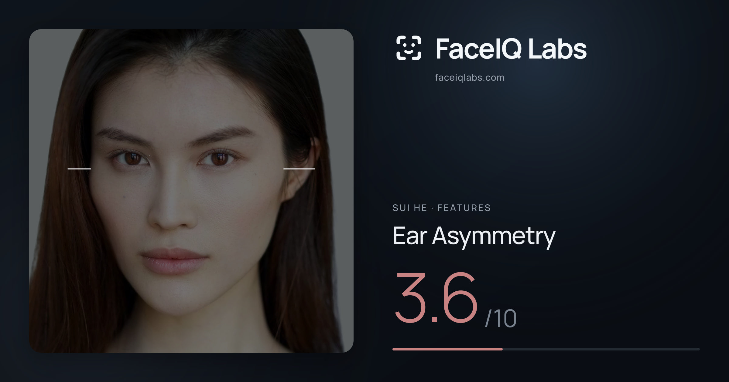 Sui He Ear Asymmetry: 3.6/10, drawn on the photo