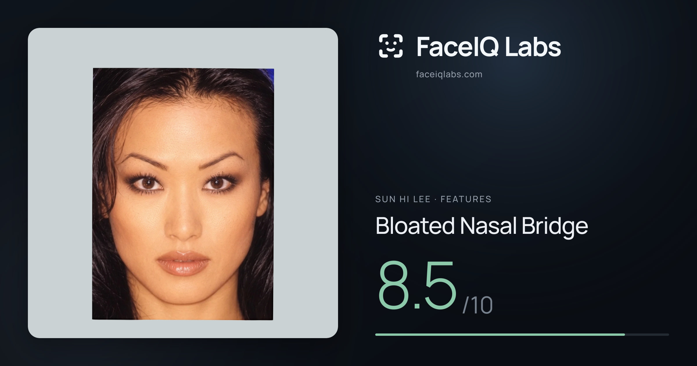 Sun Hi Lee Bloated Nasal Bridge: 8.5/10, drawn on the photo